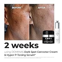 Vista 4 de DOMINAS Crema correctora de manchas oscuras Fórmula avanzada con niacinamida, TXA, hexilresorcinol y bakuchiol para reducir visiblemente