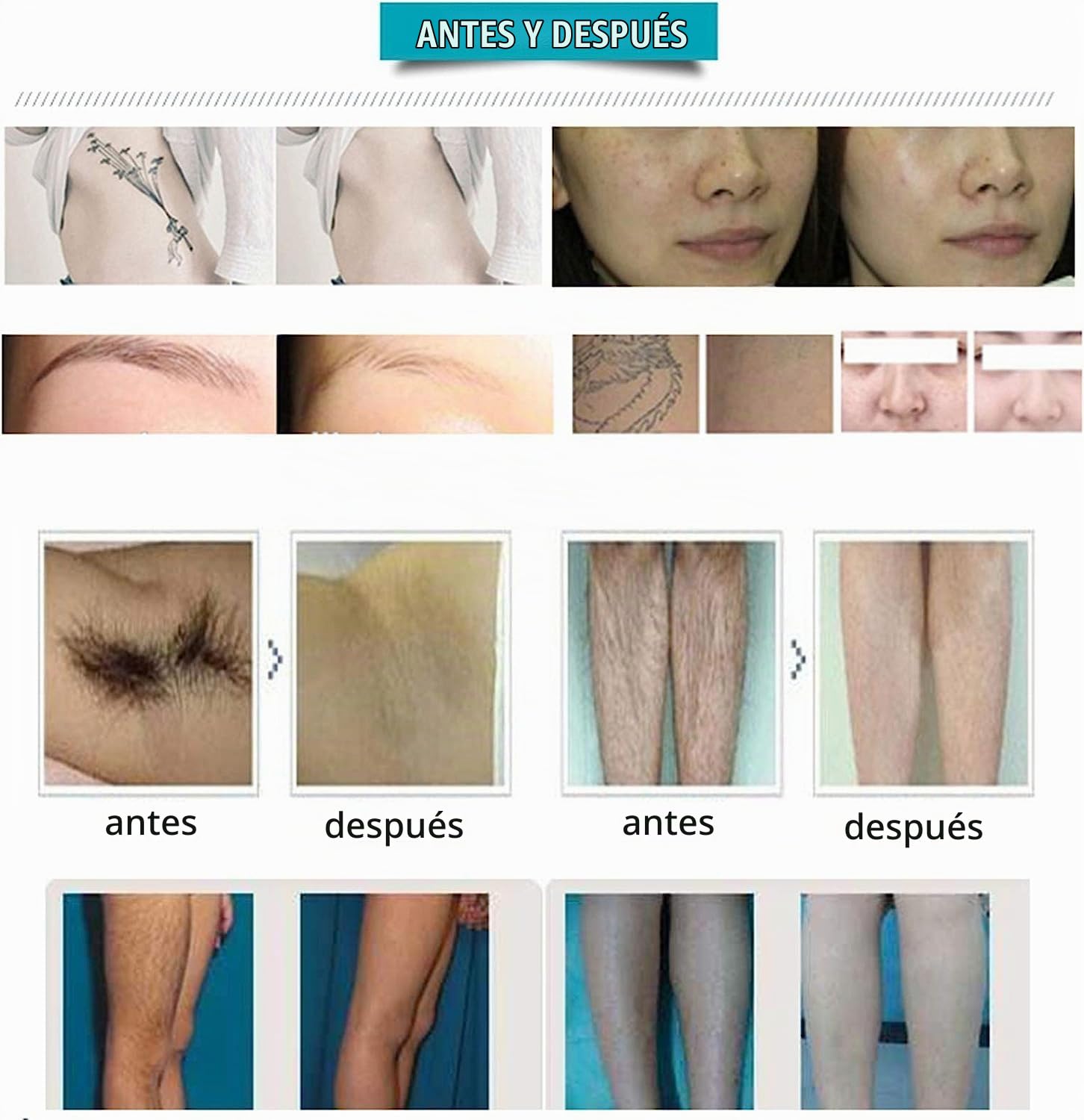 Máquina de depilación 2 en 1 Opt + IPL ND YAG Eliminación de Tatuajes con láser SHR Equipo de Belleza for Manchas oscuras en la Cara