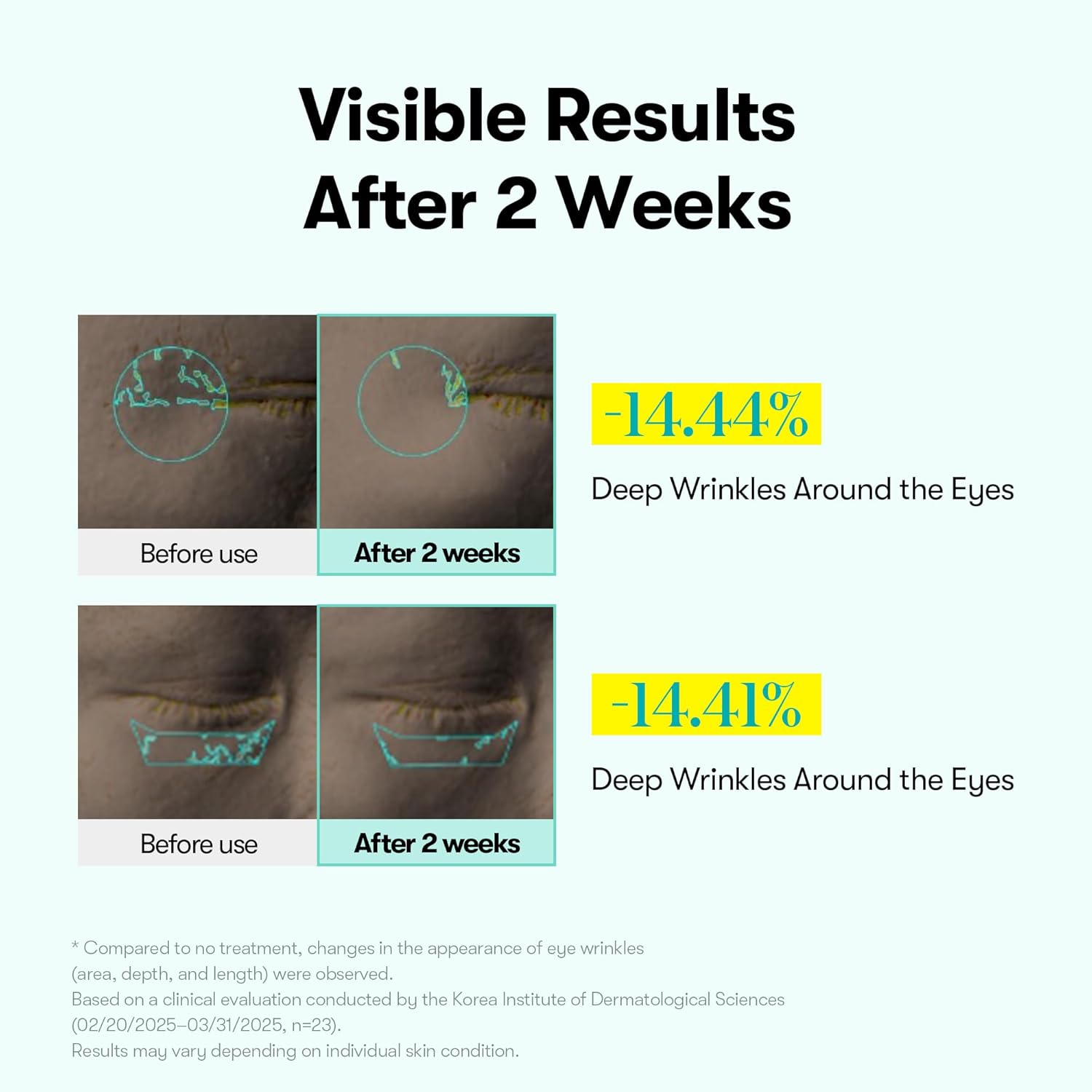 VT COSMETICS PDRN Reedle Shot Firming Eye Cream (0.51 fl oz / 15ml), Ultra-Micro Vibration Eye Cream for Firming & Elasticity, Targeted Wrinkle Care, PDRN Collagen, Korean Skincare