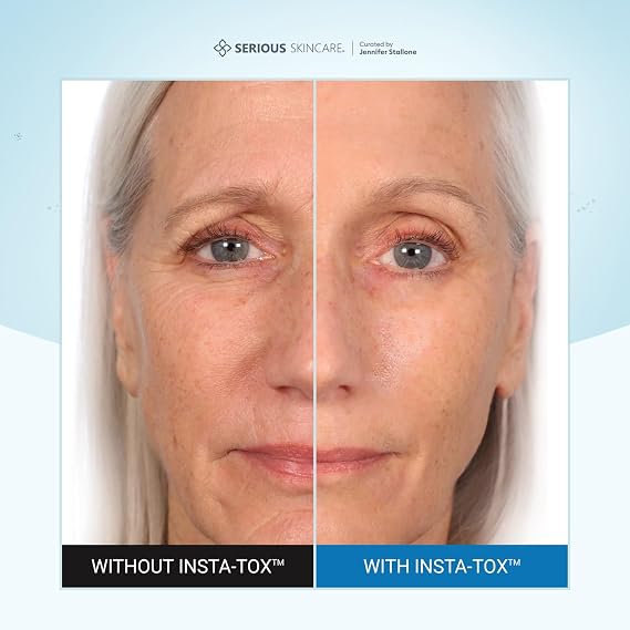 Serious Skincare INSTA-TOX Instant Wrinkle Filler for Face Serum, to Smooth + Blur Fine Lines, Deep Wrinkles, Lip Lines, Crows Feet & Pores, Temporary Face Tightener, .75 oz (Pack of 2)