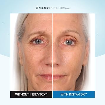 Serious Skincare INSTA-TOX Instant Wrinkle Filler for Face Serum, to Smooth + Blur Fine Lines, Deep Wrinkles, Lip Lines, Crows Feet & Pores, Temporary Face Tightener, .75 oz (Pack of 2)