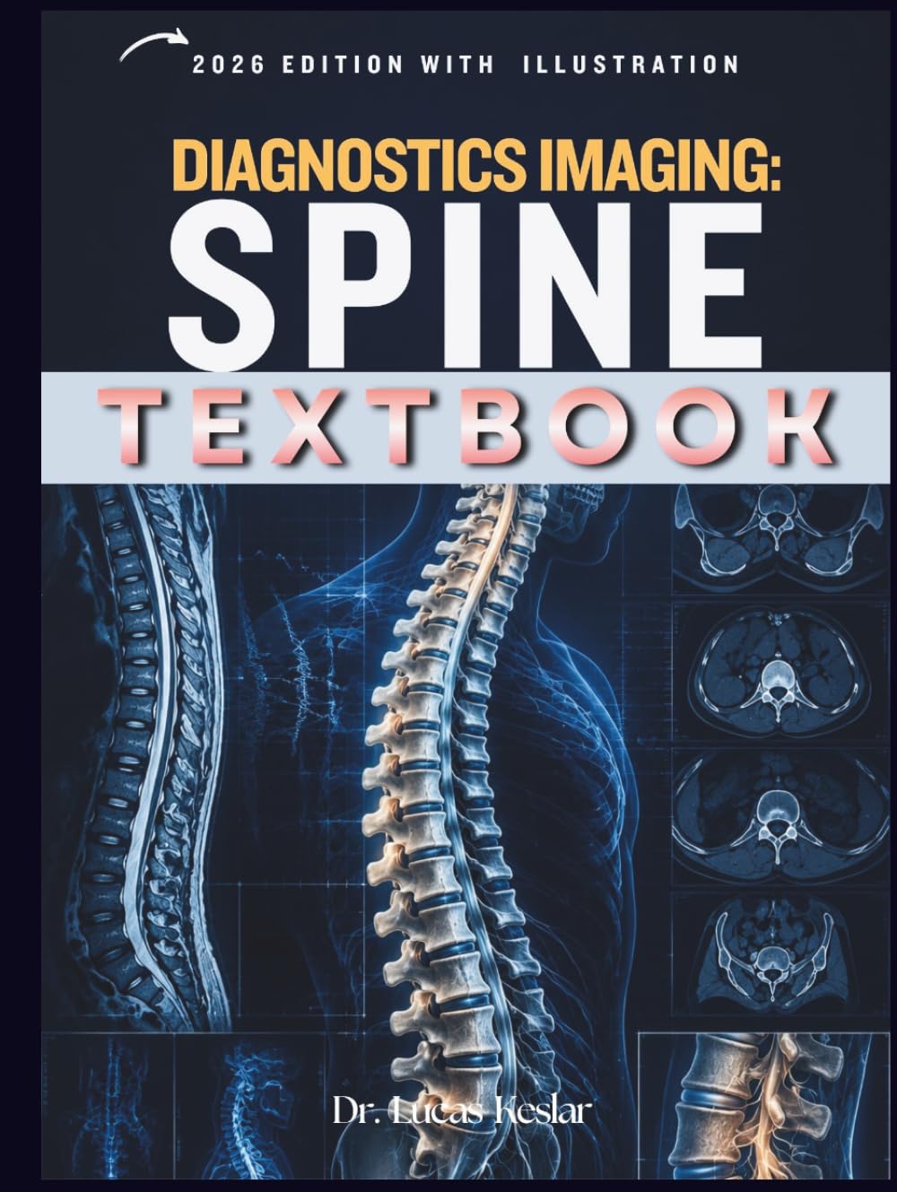 DIAGNOSTIC IMAGIN: Spine: A Practical Guide to Spine Anatomy, Pathology, Imaging Protocols, Differential Diagnosis, Case-Based Learning, Review Questions, and Reporting Essentials