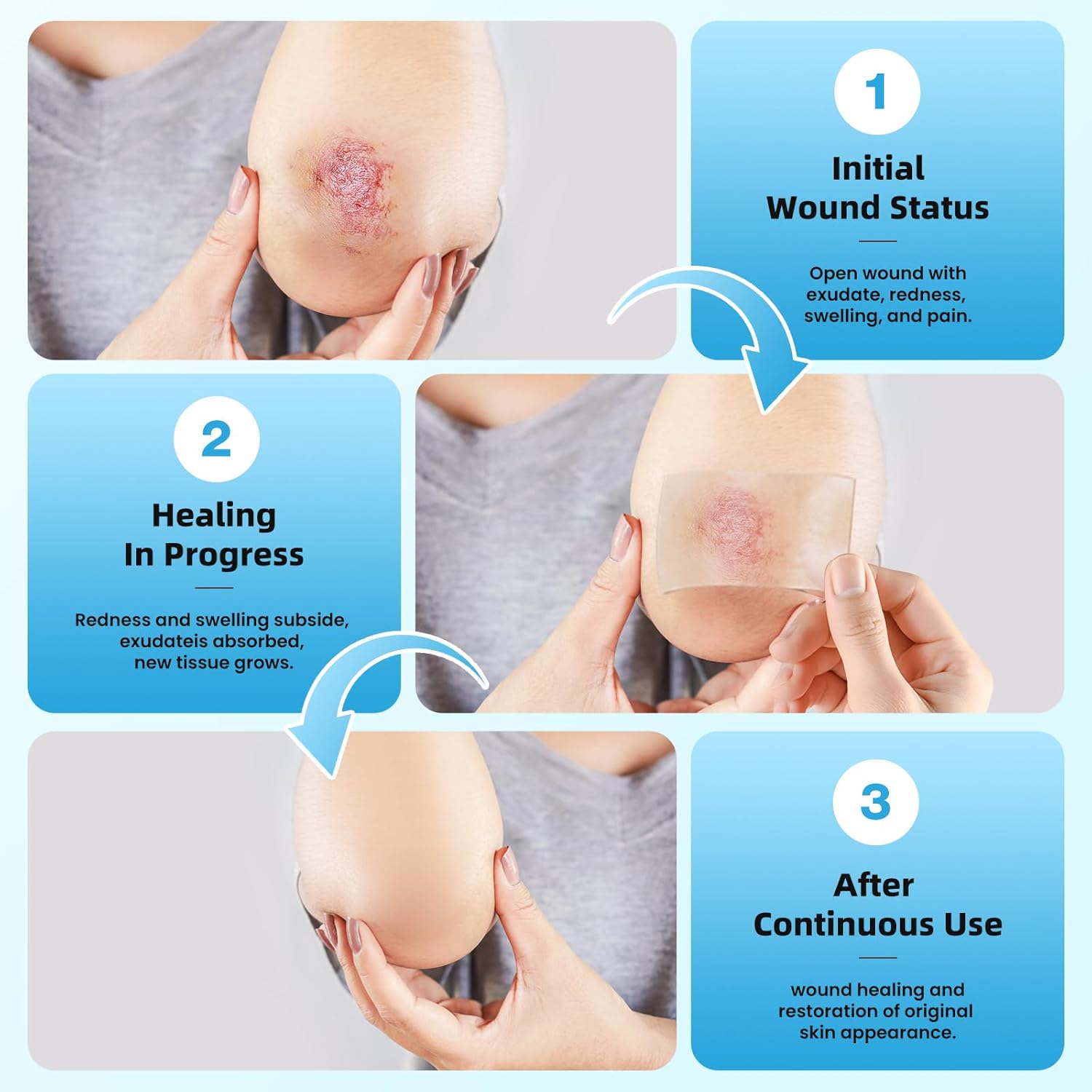 Hydrocolloid Roll Bandages, 2IN x 16FT Extra Large Hydrocolloid Patch with Self-Adhesive, Ultra Absorbent, Cut-to-Size, Flexible & Waterproof for Burn, Blister, Acne Care