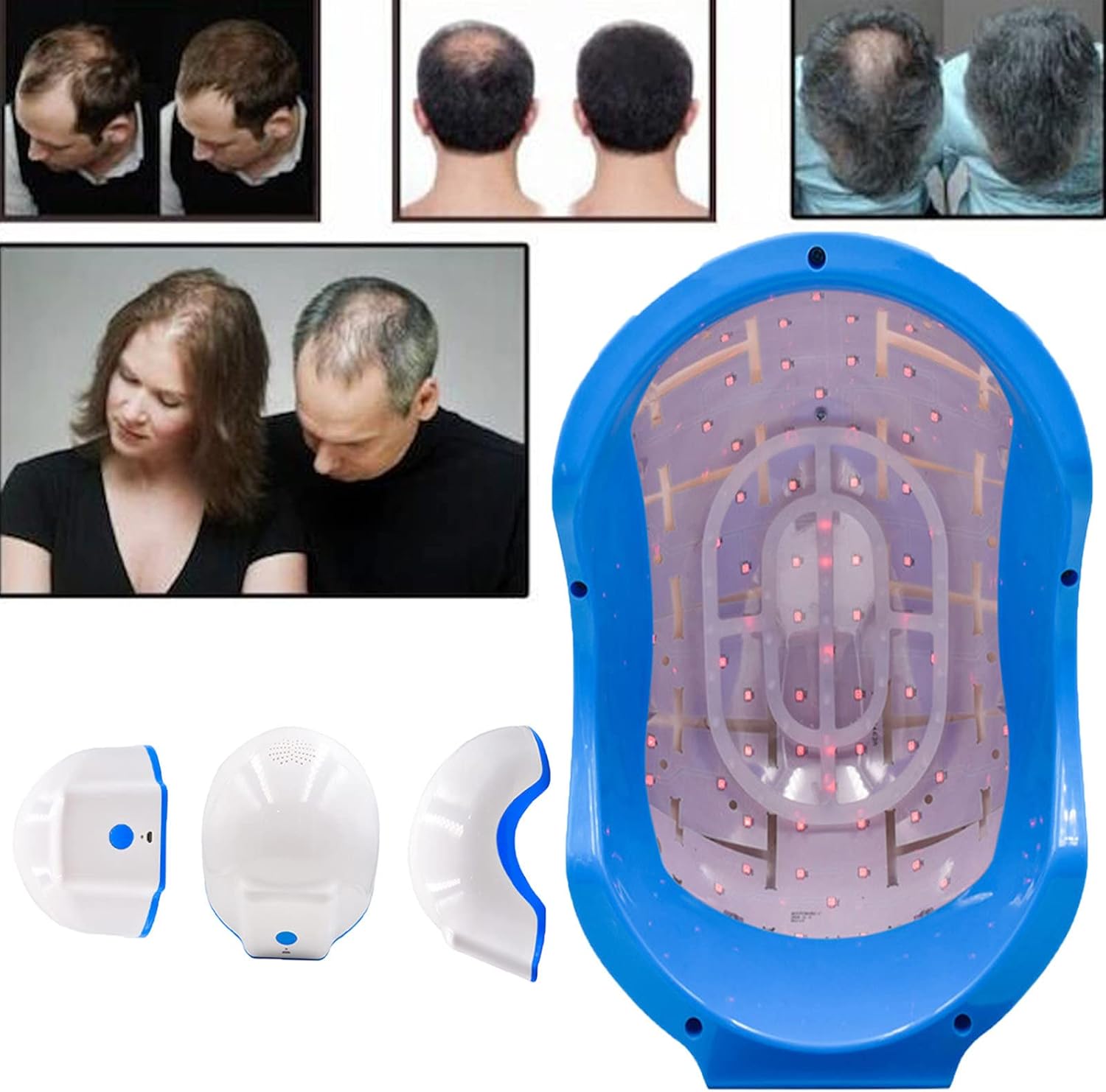 Laser Haargroeihelm Lichttherapie voor Haargroei En Behandeling Van Haaruitval Reguleert Olieafscheiding En Voedt de Hoofdhuid Seborrheic Alopecia,Erfelijke Alopecia,Alopecia Areata