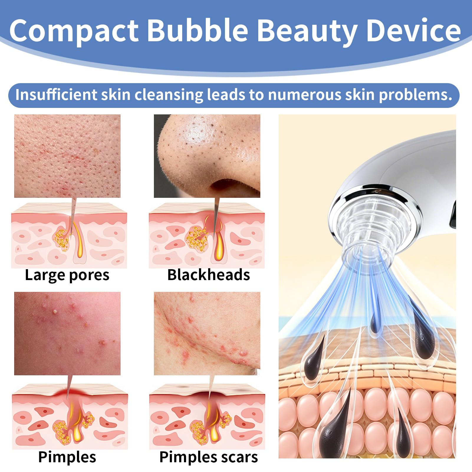 Succionador de Puntos Negros y Limpiador de Poros Facial Eléctrico, Extractor de Puntos Negros con 6 Cabezales y 3 Modos para Limpieza Profunda, Quita Puntos Negros y Acné, Recargable USB
