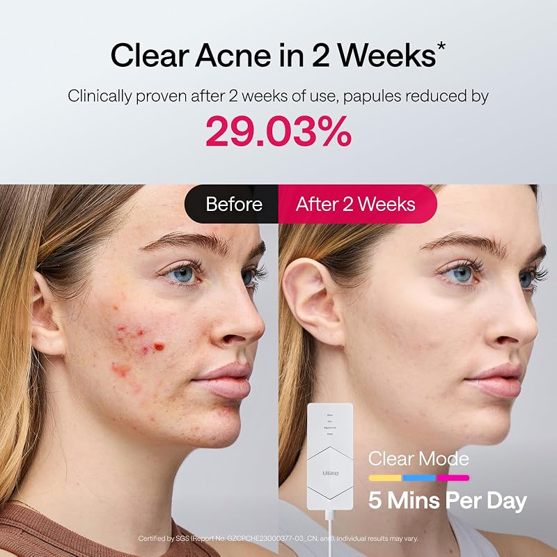 Ulike Red Light Therapy Mask for Face,360° full face coverage image 3