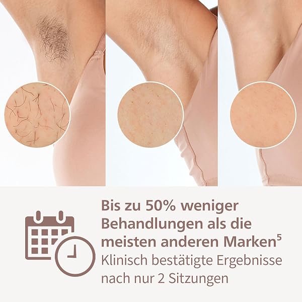 Philips Lumea IPL Series 8000 – IPL-Gerät zur Haarentfernung, Alternative zur Laser-Haarentfernung, inkl. Trimmer und 4 Aufsätzen für Körper, Gesicht, Bikinizone & Achseln (BRI949/00) - 3