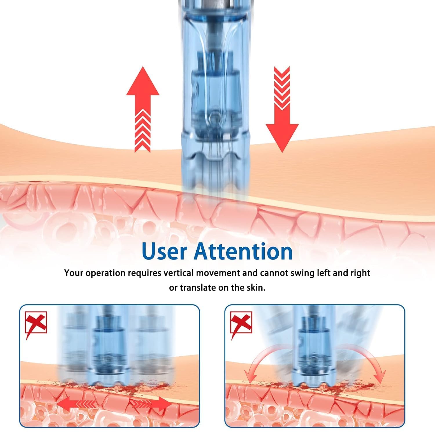 Microneedling Pen M8S, Dermapen professionale Dr.pen wireless con 6 aghi di ricambio 12 pin 36 pin, 6 livelli di velocità regolabili da 0,25 a 2,5 mm