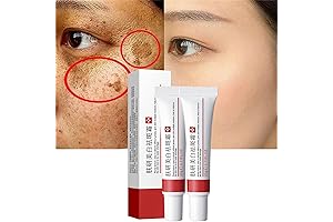 2 Pcs Whitening Freckle Cream: The Ultimate Skin Tag Removal Solution