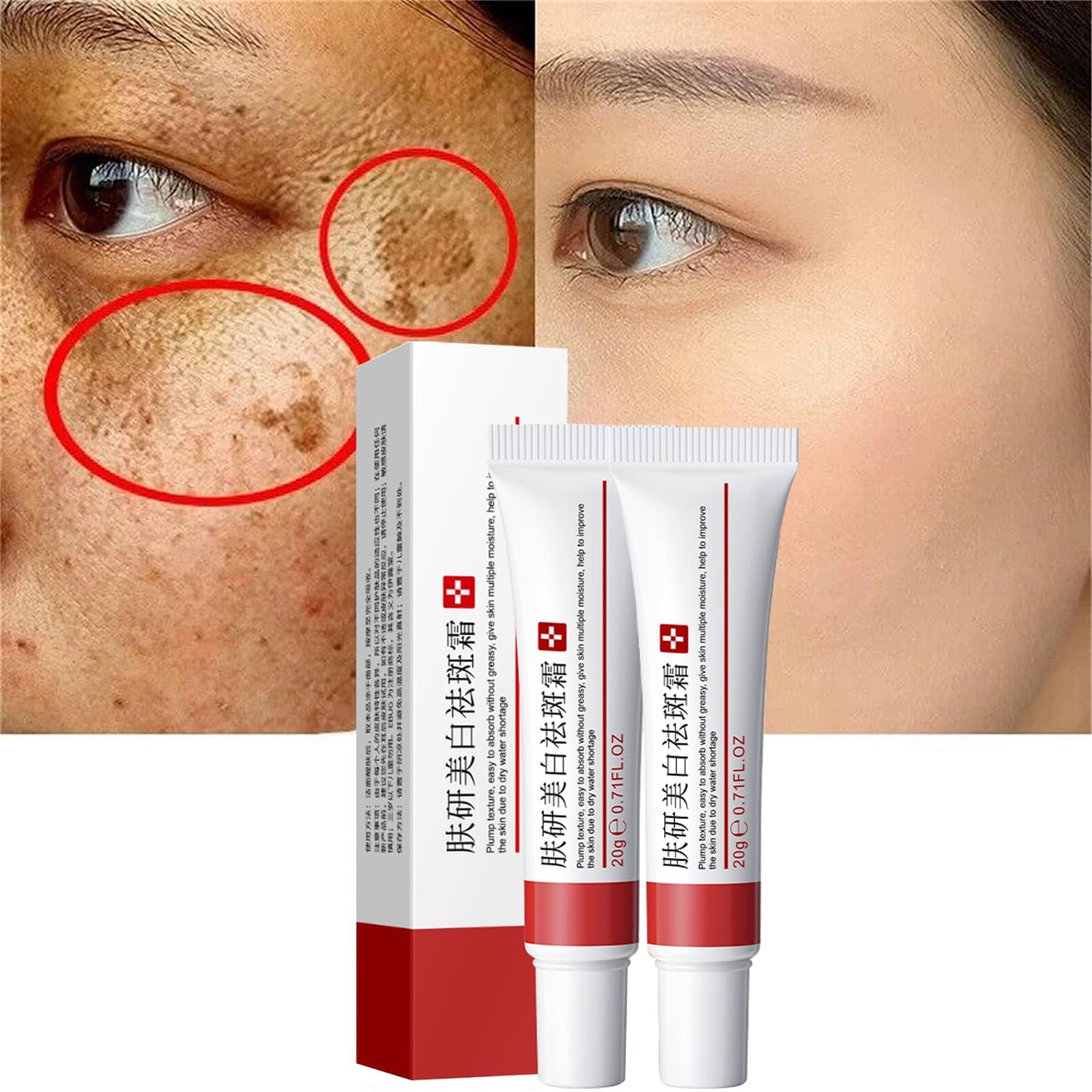 2 Pcs Freckle Cream, Acne Scar Removal Treatment Cream, Pigmentation Removal Cream for Face, Moisturizing Removes Facial Melasma Dark Spots Wrinkles Blemishes (freckle cream)