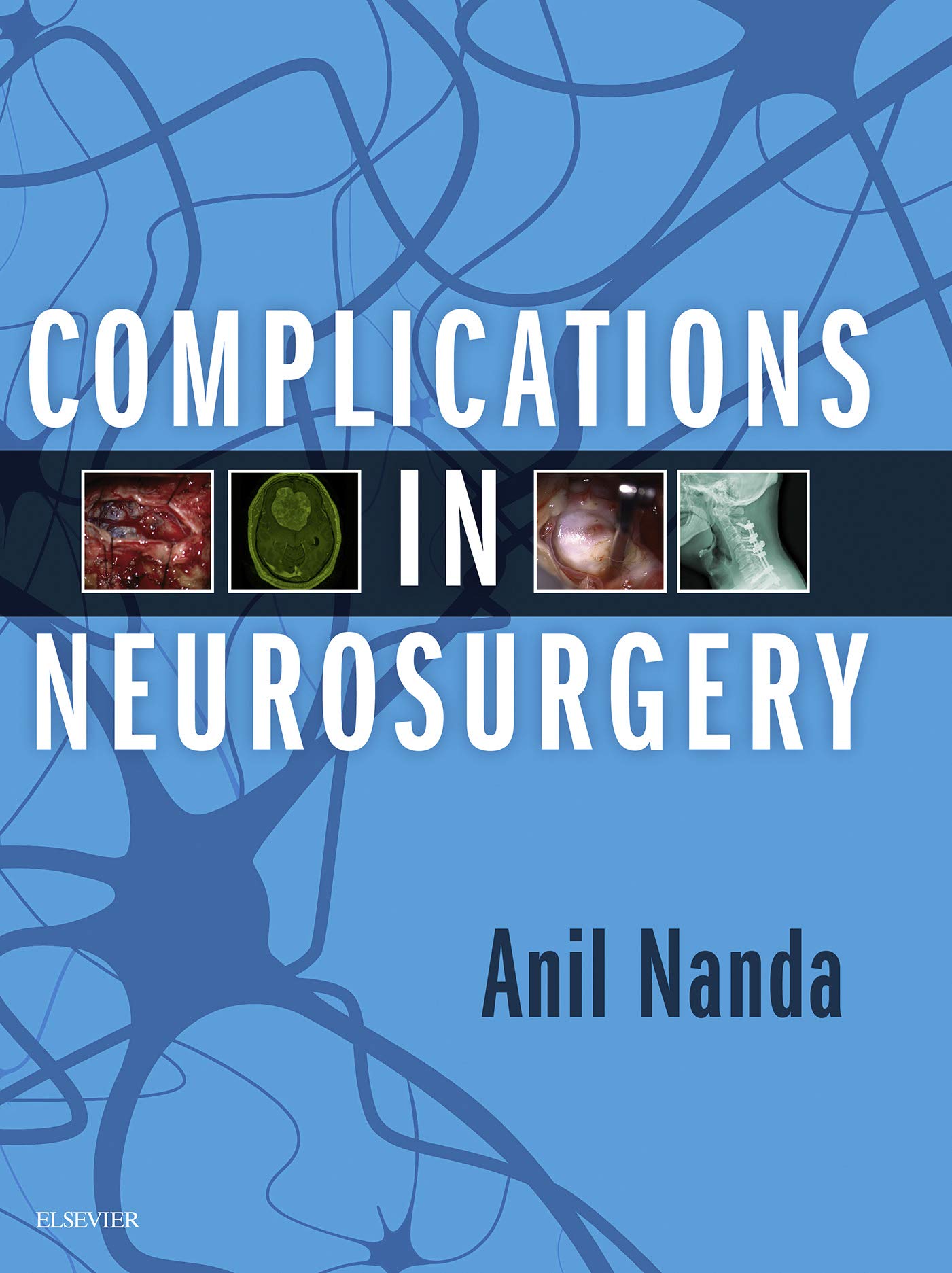Complications in Neurosurgery E-Book (English Edition)