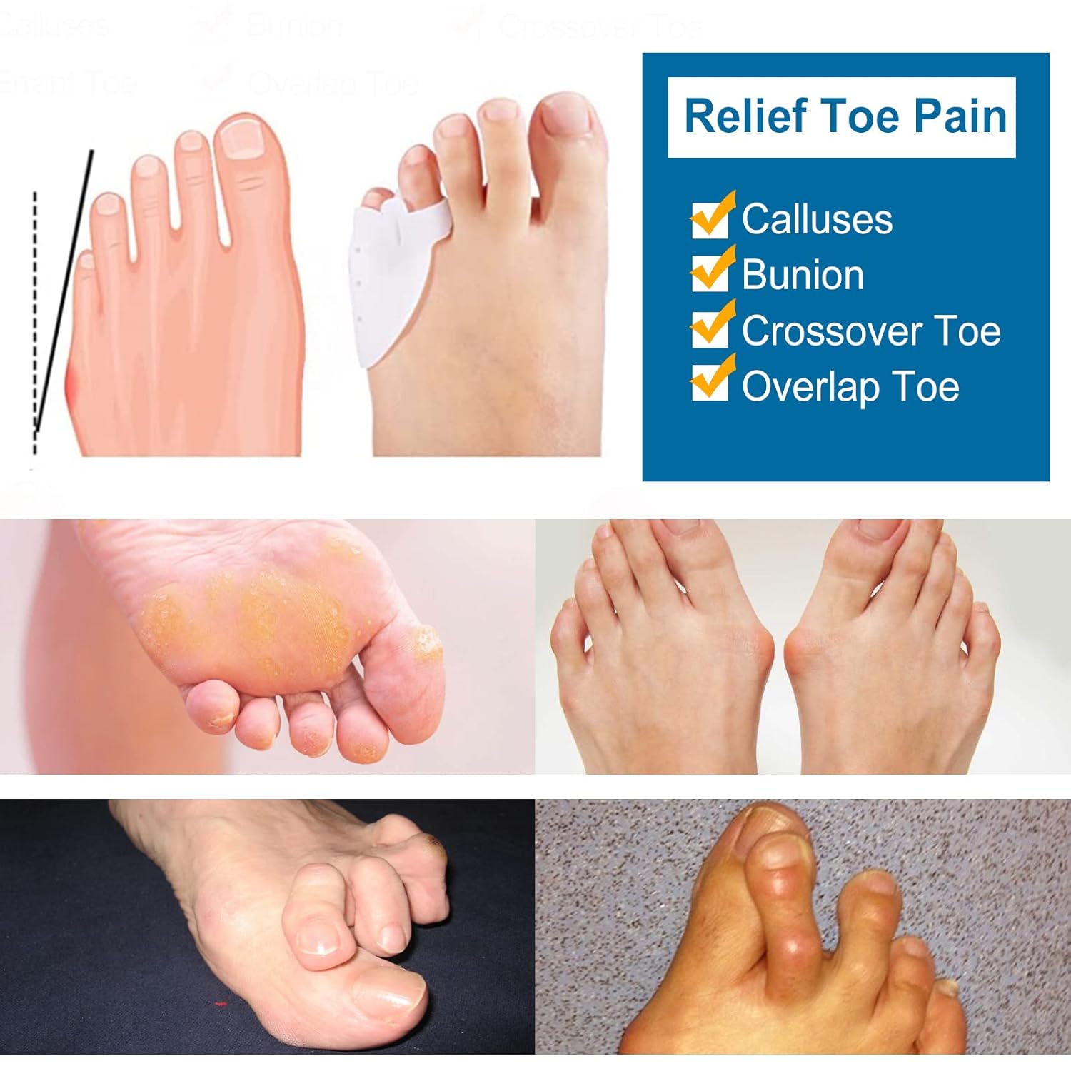6Pcs Pinky Toe Protector, Pinky Toe Gel Bunion Protector, Soft Gel Toe