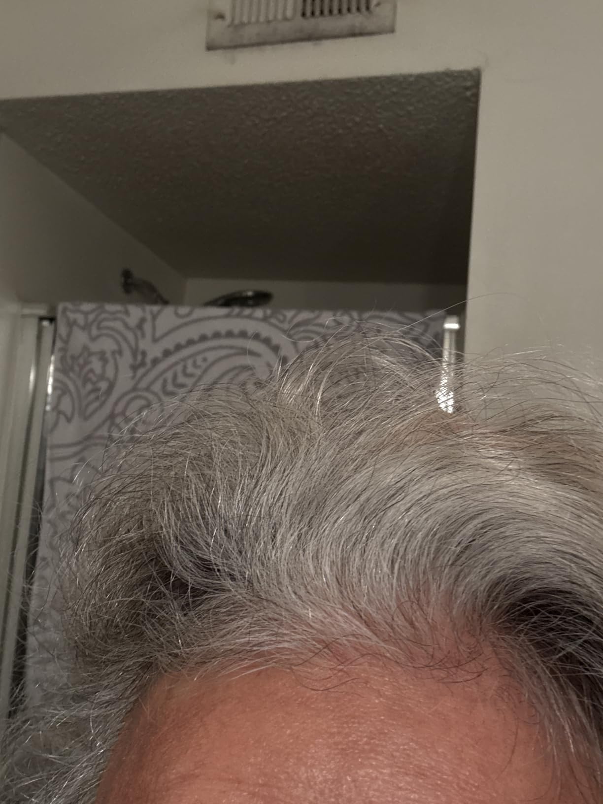 Súper no tenía cabello y ya salieron con un solo pomo van haber los resultados