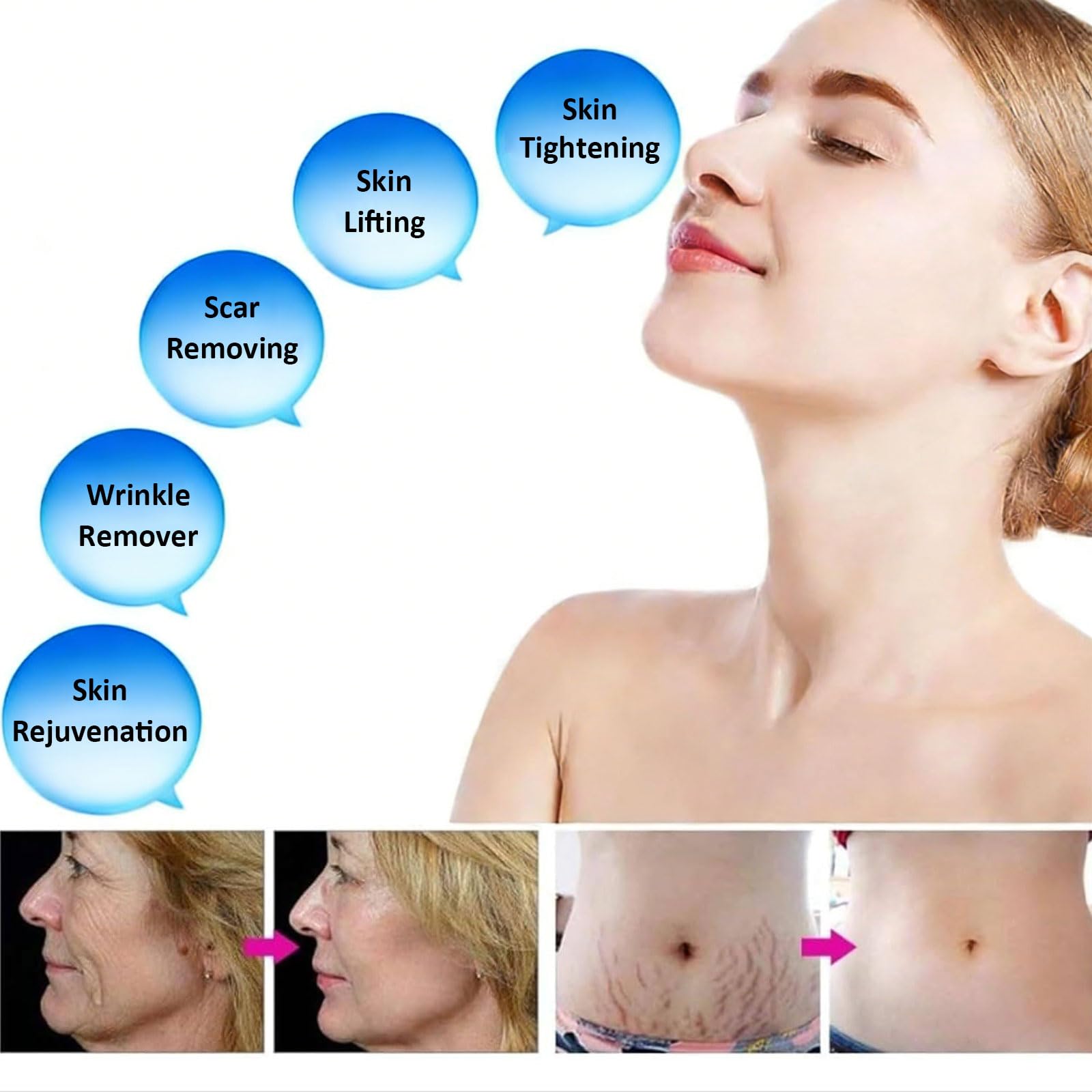 Morpheus 8 Dispositivo Portatile Microneedling Radiofrequenza per Effetto Lifting Rassodante Eliminazione Marchi Cutanei Ringiovanimento Pelle e Correzione Imperfezioni Professionale