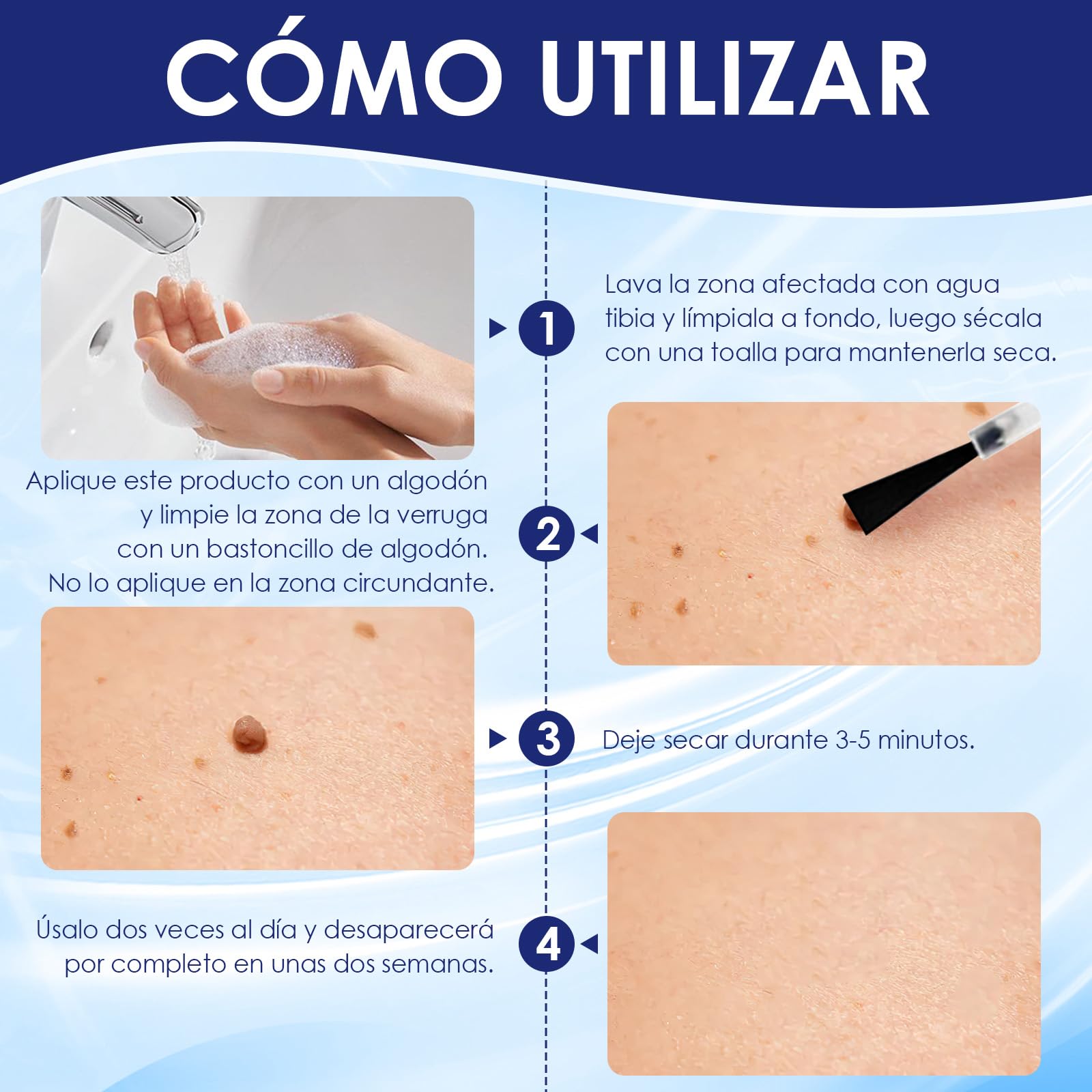 Quita Verrugas,Verrugas Quitar,Tratamiento Suave de Eliminar Verrugas,Pediculadas y Comunes1234567