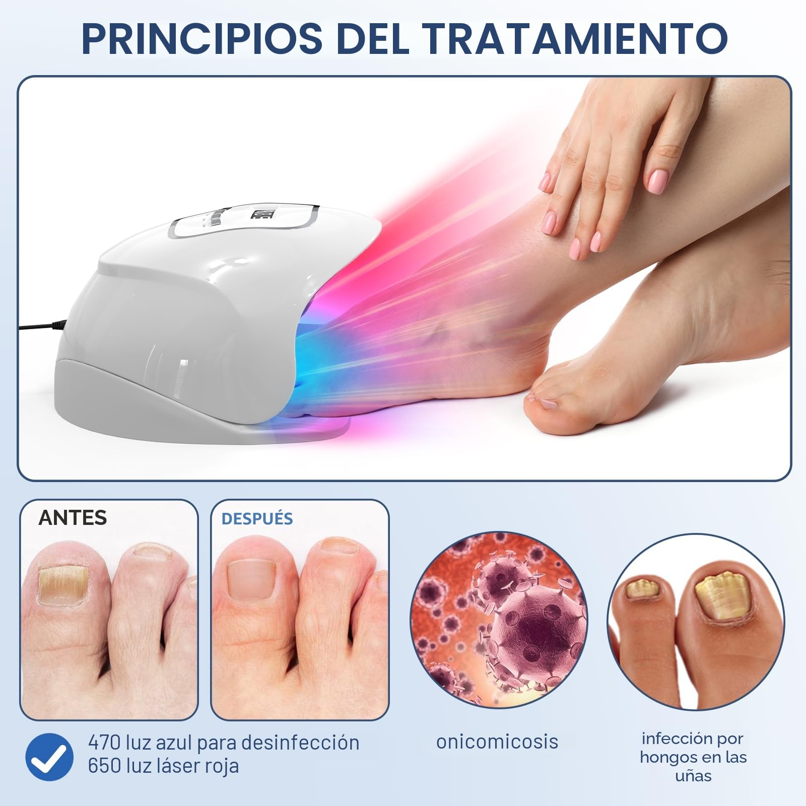 iKeener Dispositivo láser para hongos en las uñas, aprobado por la FDA, limpieza de uñas y onicomicosis, eliminador de hongos con luz azul de 15 x 470 nm + 30 x 650 nm luz roja, sesiones