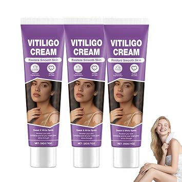 Vitiligo Cream, Vitiligo Treatment Cream, Reduce White Spots,Easy to Use