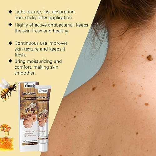 Miniatura 4 de Ungüento de eliminación de verrugas de veneno de abeja de acción rápida, crema de tratamiento profesional para eliminar verrugas de veneno de abeja,