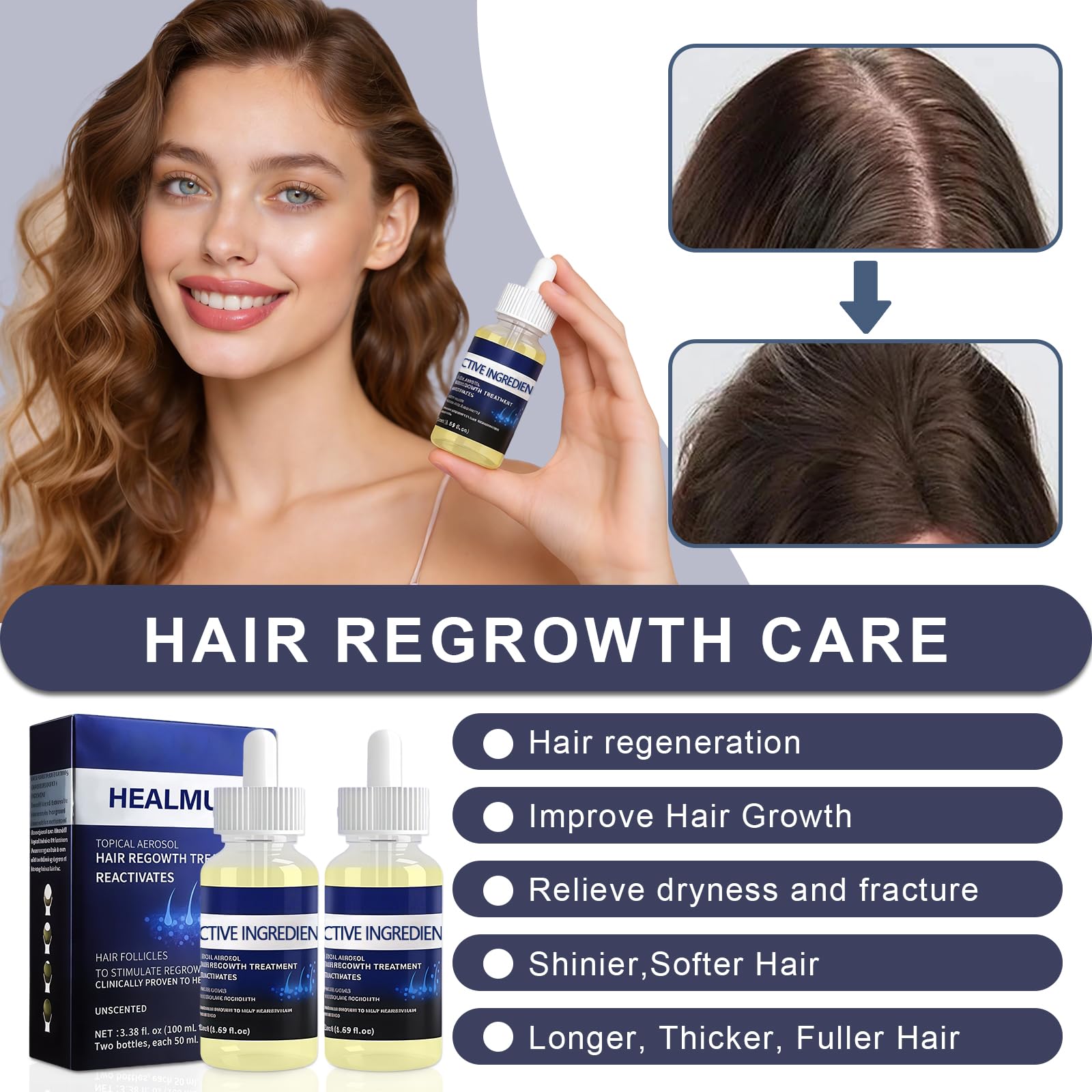 2 Piezas 50ML Serum Anticaida para el Cabello, Nutre el Cuero Cabelludo, Fortalece el Cabello, Nutre el Acelerar Crecimiento del Cabello, Fácil de aplicar para Hombres y Mujeres — view 2