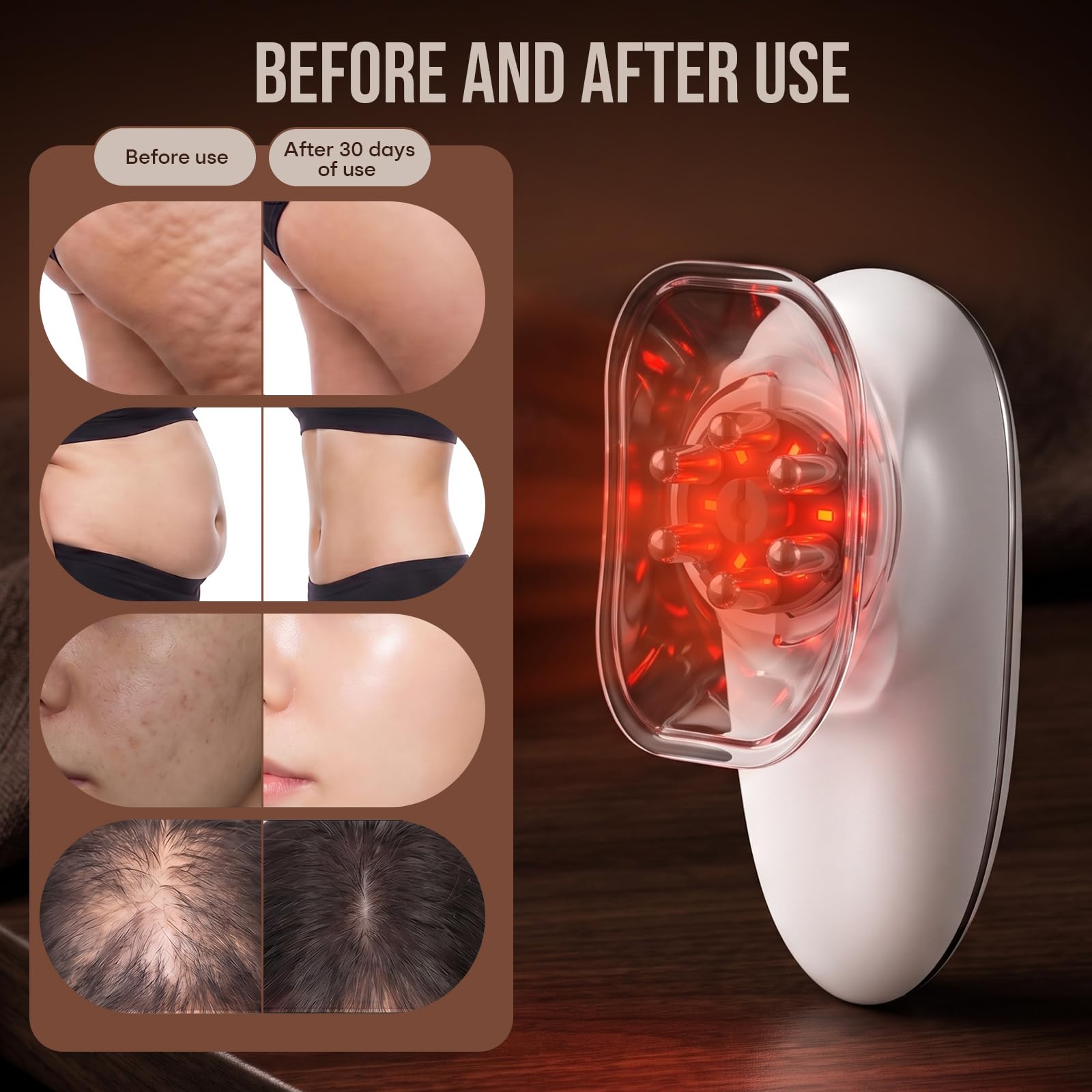 3-in-1 Anti Cellulite Massagegerät (Saugleistung 28-40kPa),Schröpfgerät Elektrisches、EMS & Rotlicht Funktion,zur Straffung,Modellierung & Hautpflege für Kopf,Gesicht & Körper gegen Cellulite
