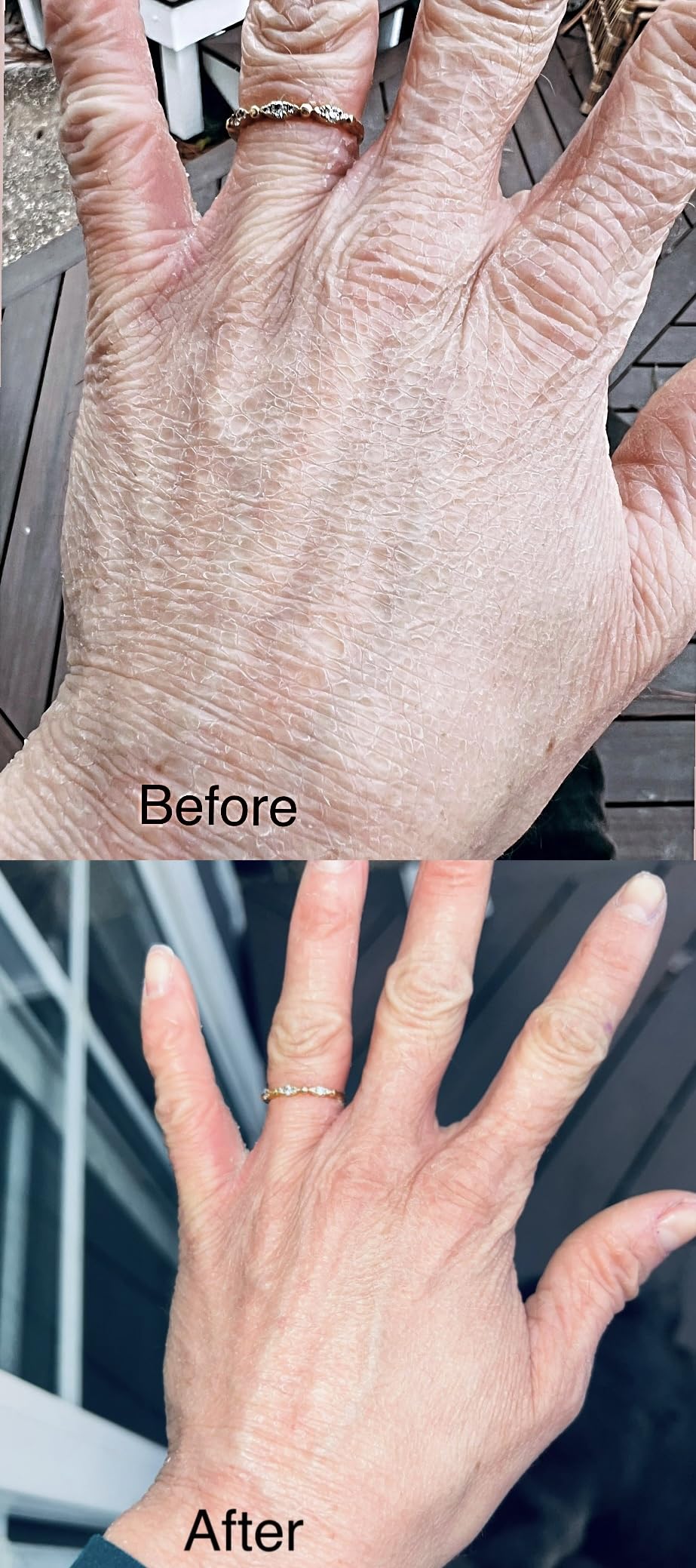 Theraplex Skin Barrier Balm- Barrier Repair Moisturizer Cream Body Balm Dry, Sensitive Skin - No Parabens or Preservatives, Noncomedogenic and Hypoallergenic - Dermatologist Recommended - 6 Oz