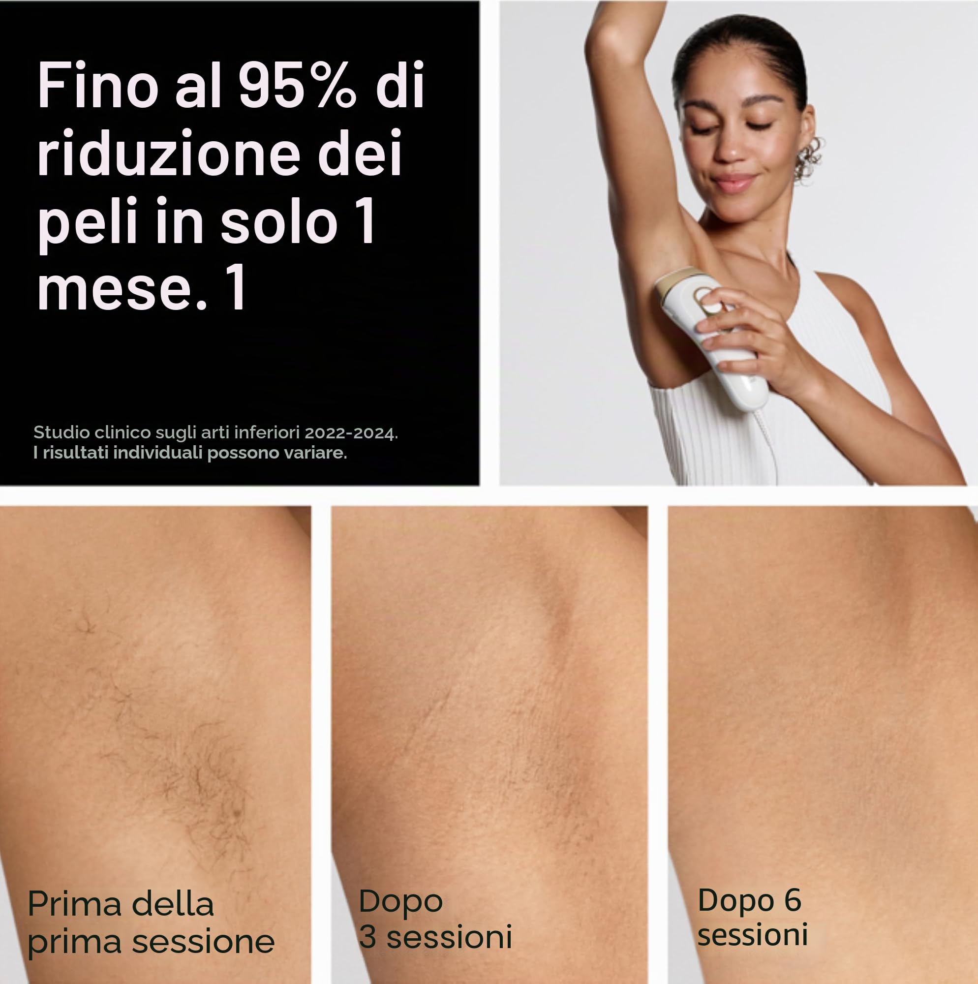 Braun Depilazione IPL, Silk Expert Pro 5 PL5157, approvato dalla FDA, corpo e viso, riduzione permanente dei capelli, alternativa laser da salone, con rasoio Venus, sacchetto
