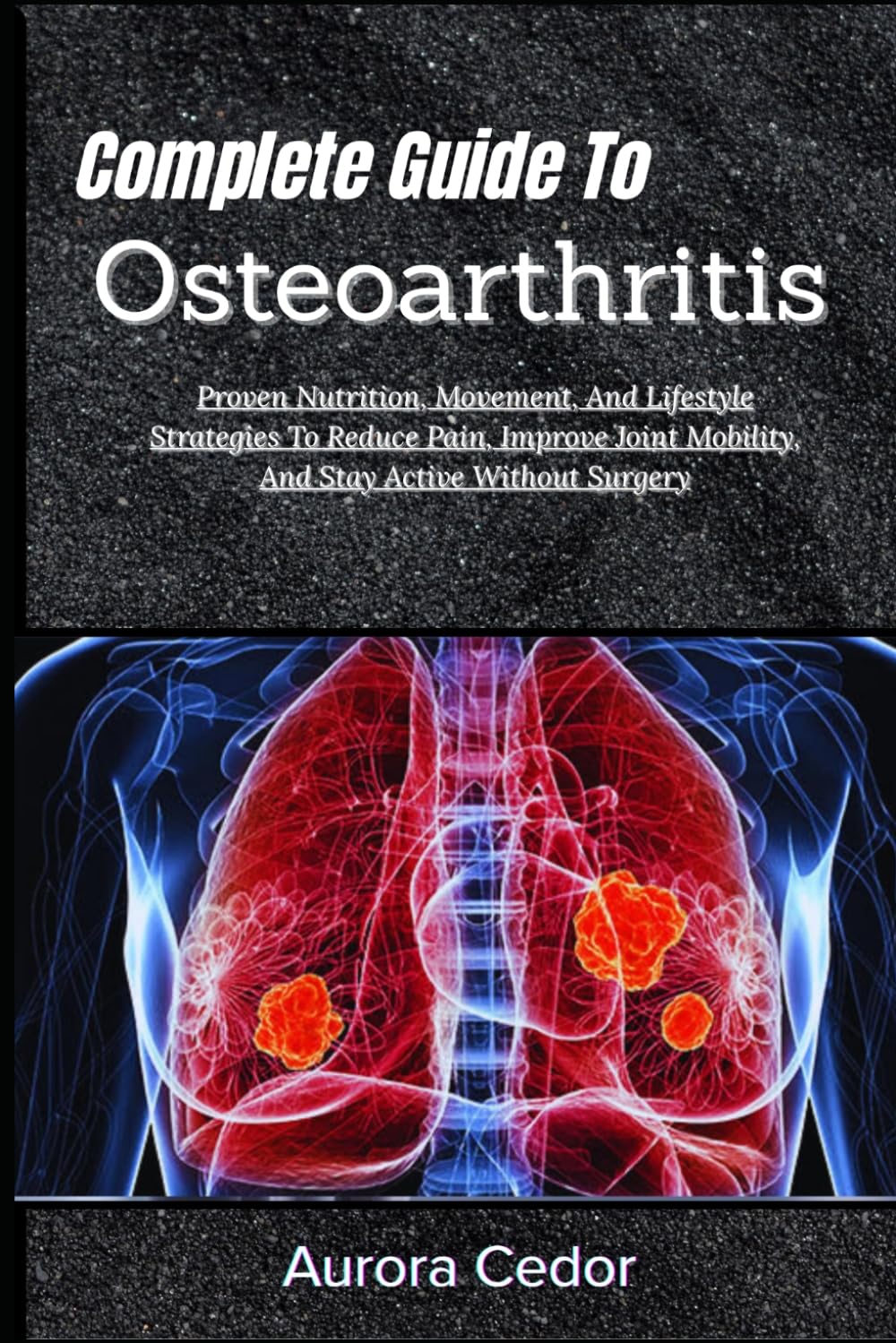 Complete Guide To Osteoarthritis: Proven Nutrition, Movement, And Lifestyle Strategies To Reduce Pain, Improve Joint Mobility, And Stay Active Without Surgery