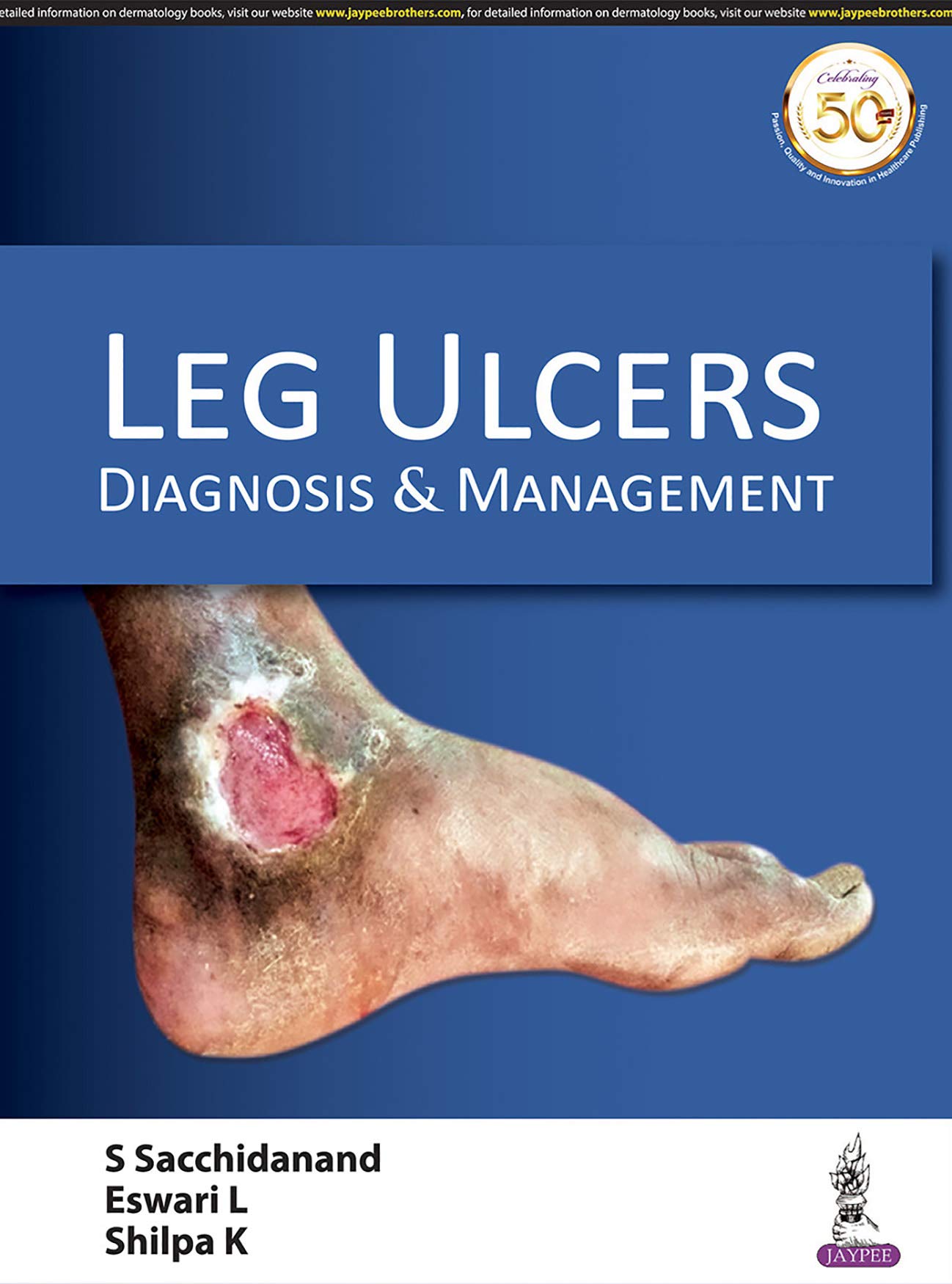 Leg Ulcers: Diagnosis & Management