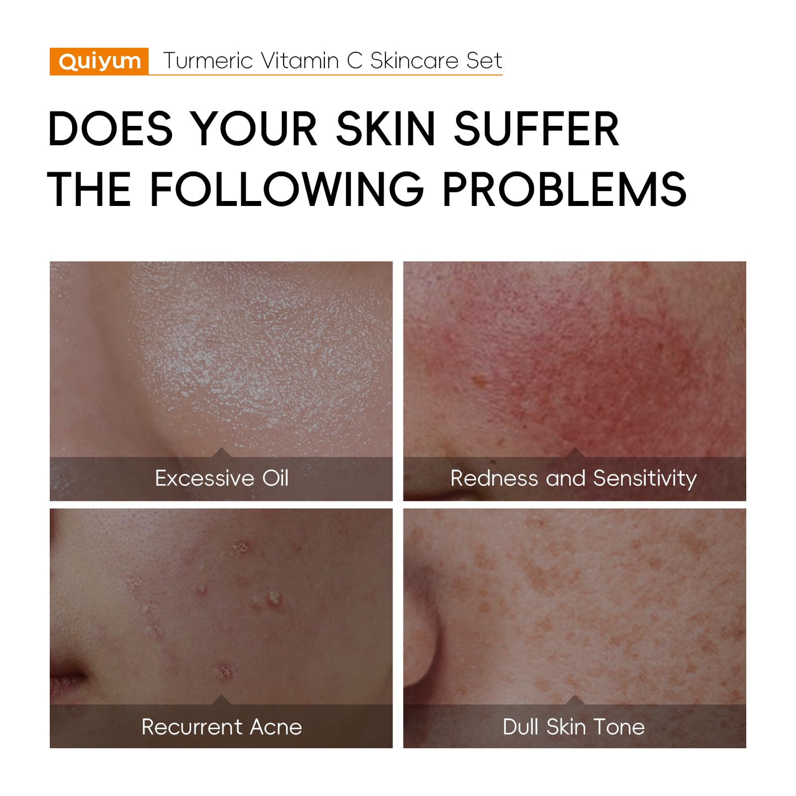 QUIYUM Set Cuidado Facial con Cúrcuma y Vitamina C, Kit de Regalo Skincare | para Mujer, Hidratante, Control de Grasa e Iluminador para Todo Tipo de Piel