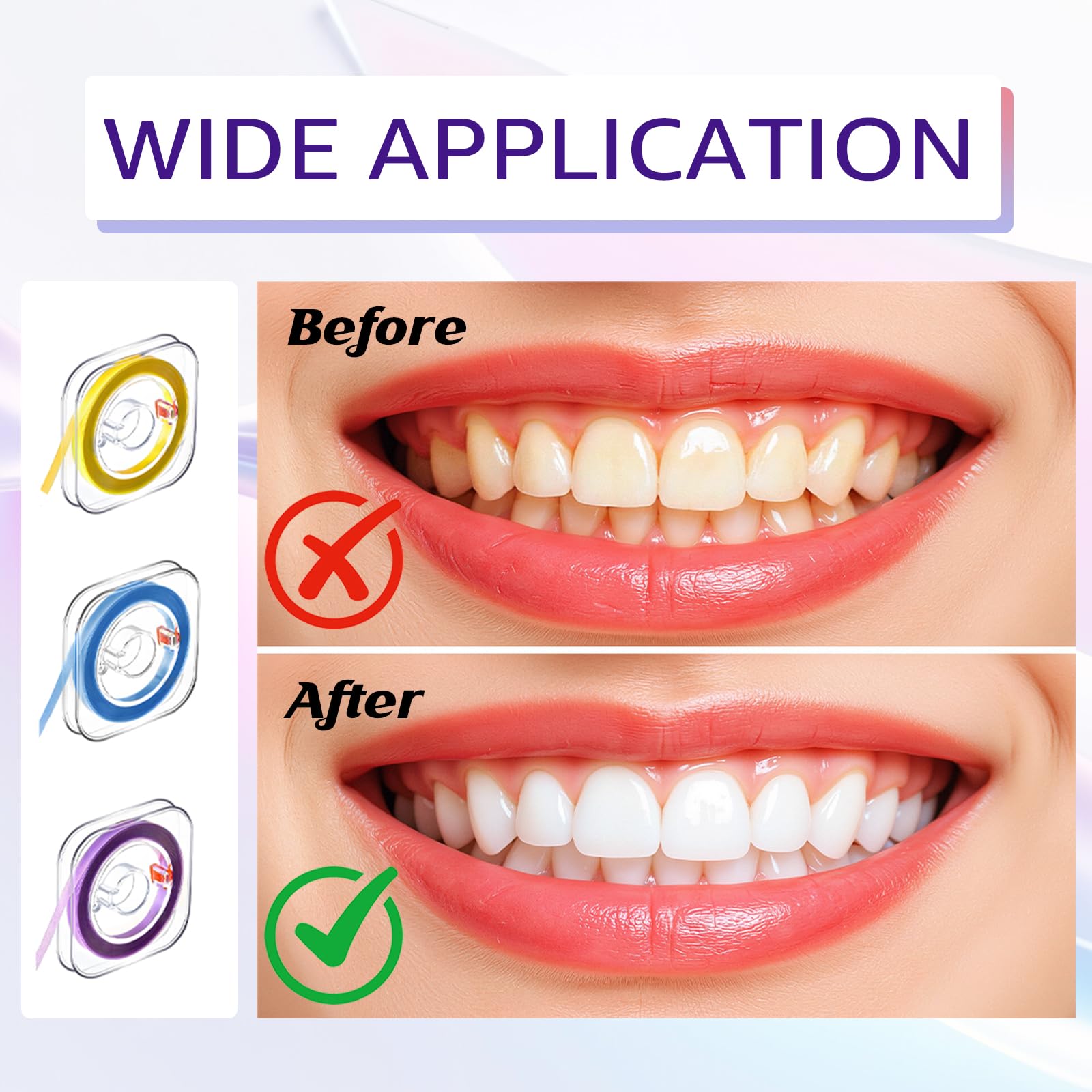 Papel abrasivo dental 3 bandas de pulido 20 30 50 μm 4 mm x 6 M para espacios intermedios