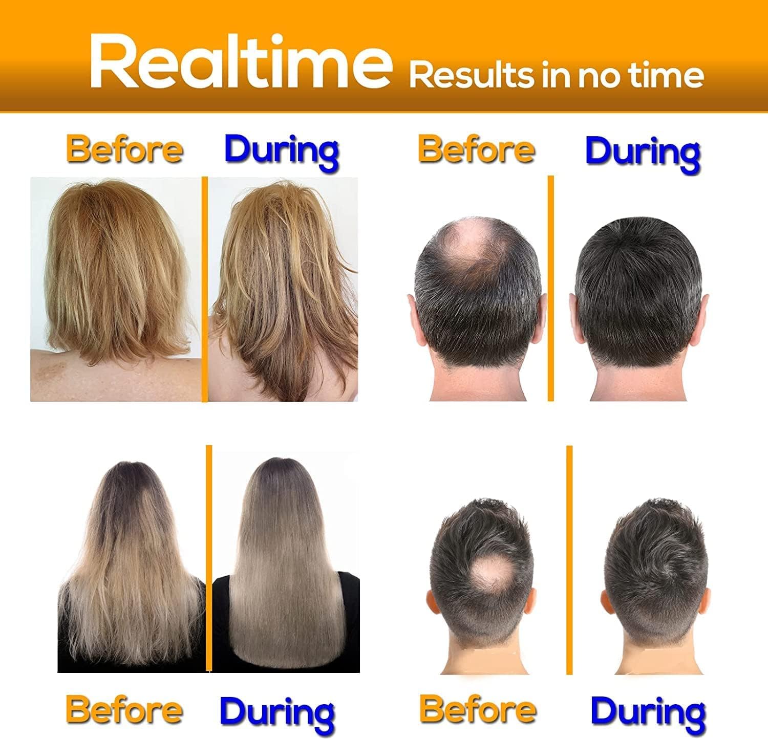Biotin Shampoo For Hair Loss - Natural Hair Loss Shampoo Enriched With Biotin & DHT Blocker Shampoo - Anti Dandruff Male & Female Hair Loss Shampoo - Hair Thicker & Shinning Shampoo - 473 ml