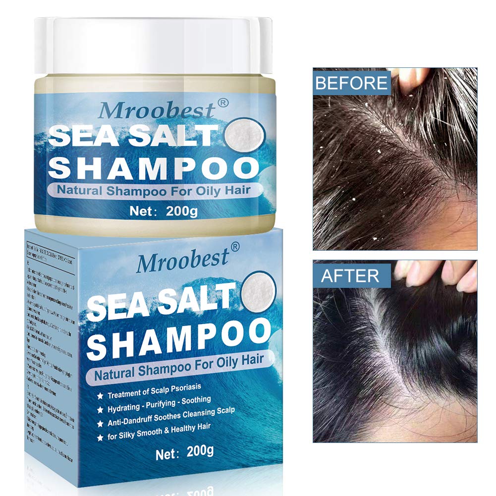 Buy Psoriasis Shampoo, AntiDandruff Shampoo, Sea Salt Shampoo, Itchy