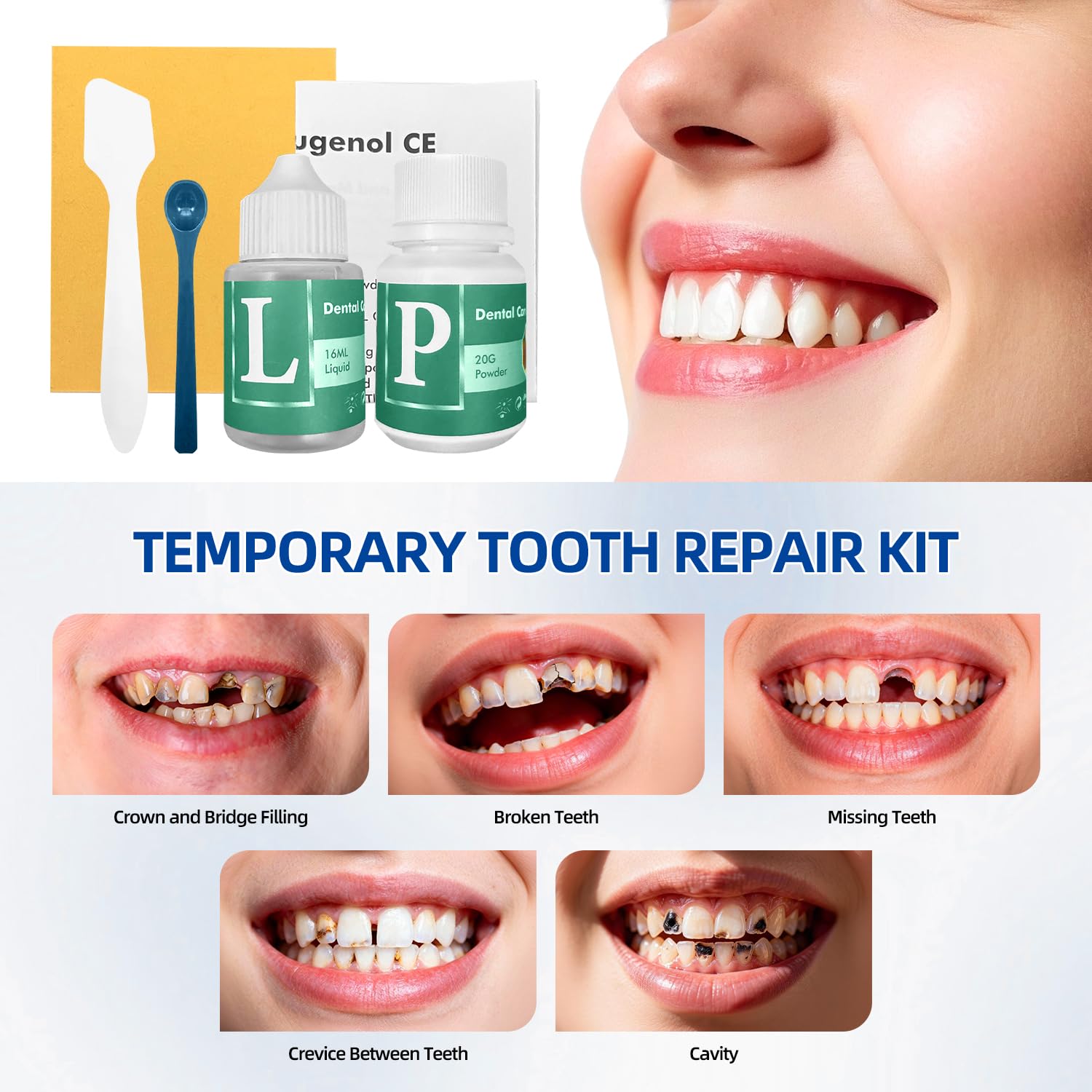 Tooth Repair Kit, Zinc Oxide Eugenol Cement for Cavities Filling, Dental Care Kit for Broken, Chipped or Missing Teeth, Temporary and Permanent Tooth Filling and Crown Fixing at Home