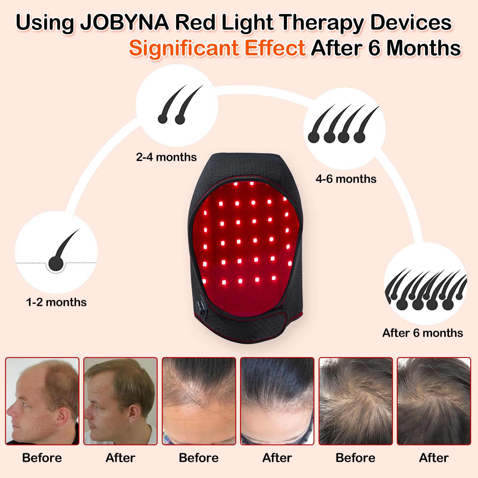 JOBYNA Thérapie par la Lumière Rouge et Infrarouge et Bleue pour la Repousse des Cheveux, Chapeau de Luminothérapie Lampe Infrarouge, Red Light Therapy pour la Perte de Cheveux, Douleur