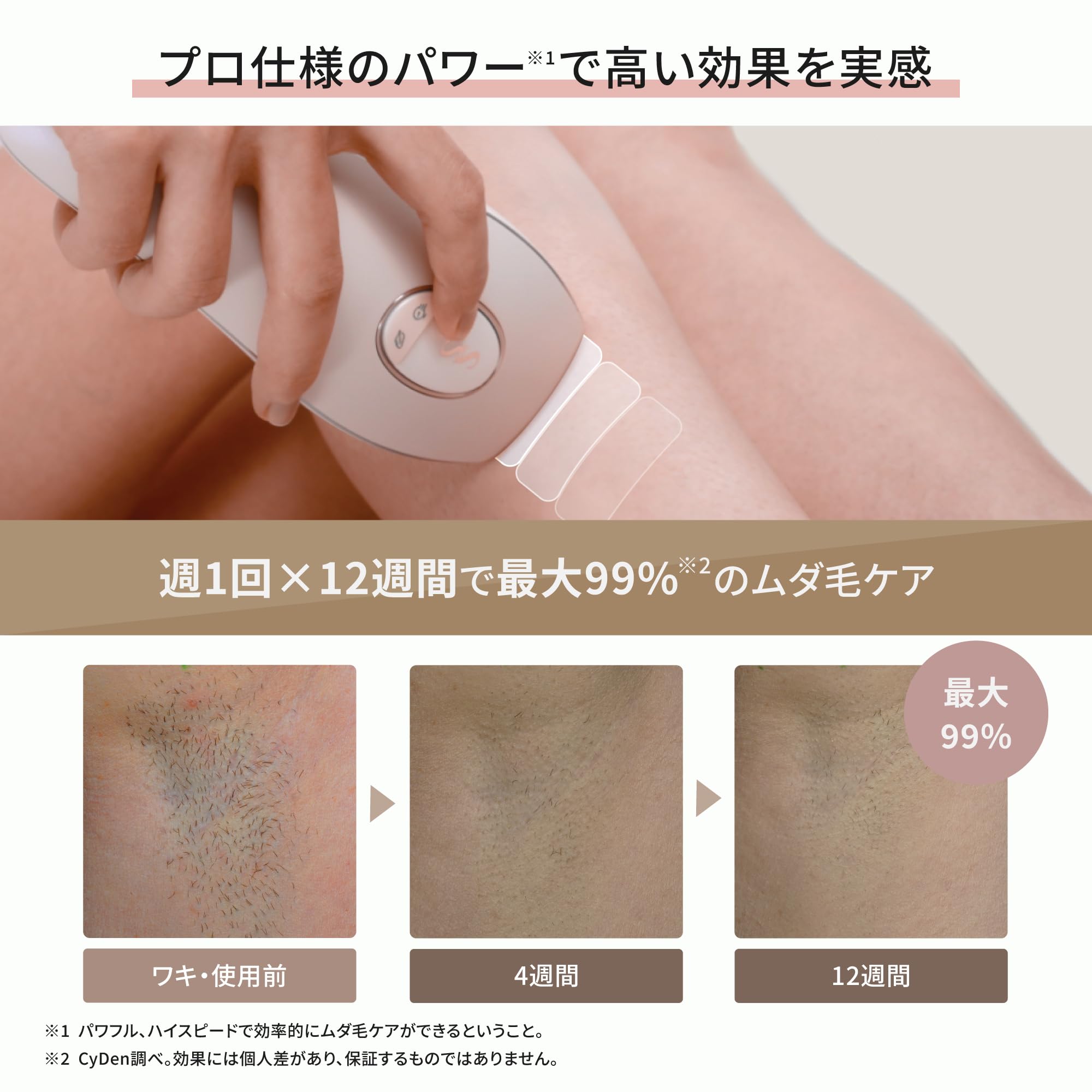 Amazon | SMOOTHSKIN Pure Adapt 脱毛器 連射モード 光美容器