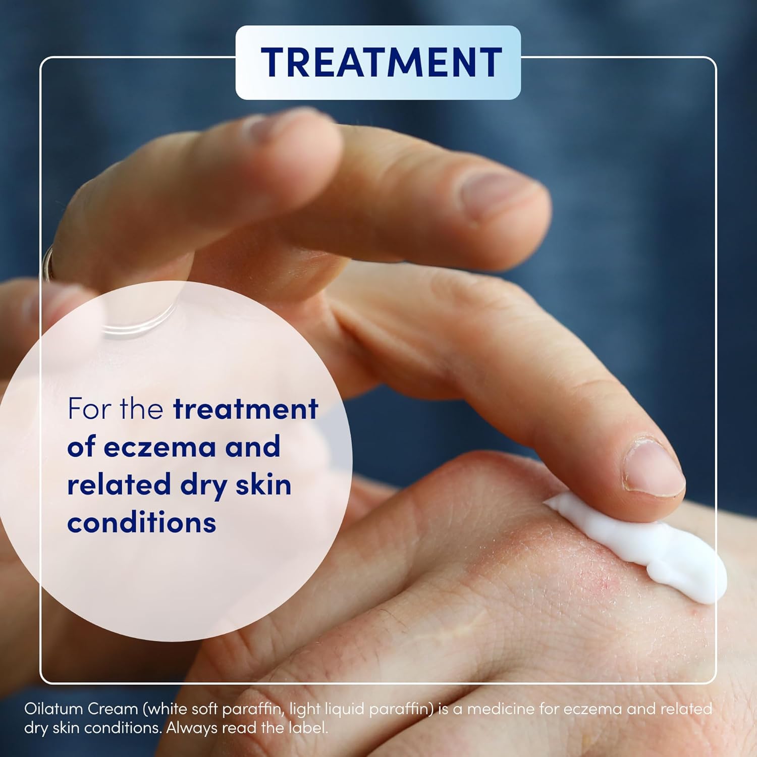 Oilatum Cream 500ml - Image 4