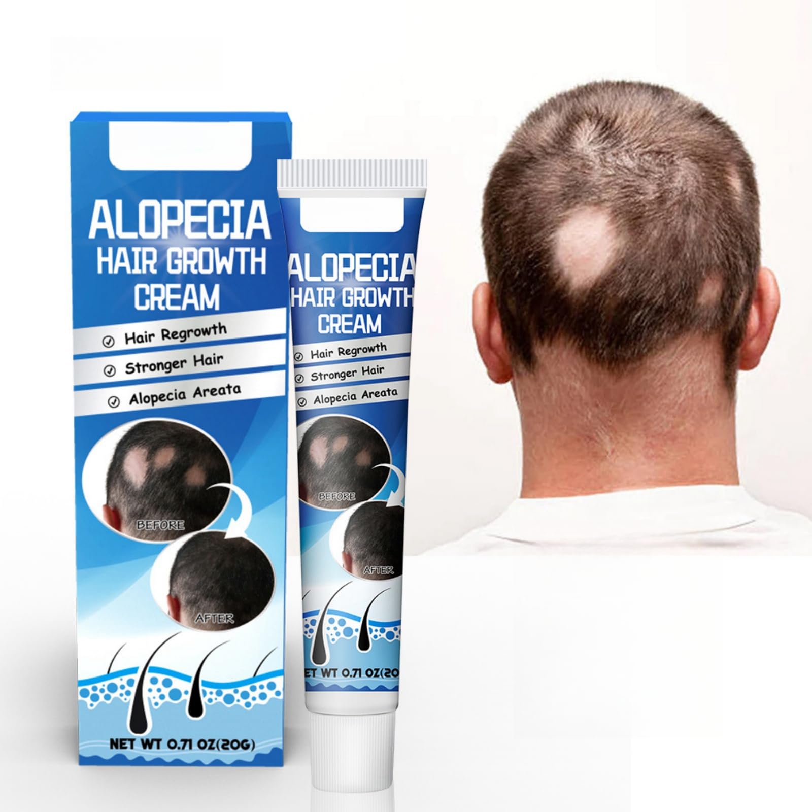 HONPOLO Alopecia Hair Growth Cream, 20g - Revitalizing Scalp and Promoting Hair Growth - Effective Treatment for Alopecia & Thinning Hair - Nourishes & Strengthens Hair Follicles - Reduces Hair Loss