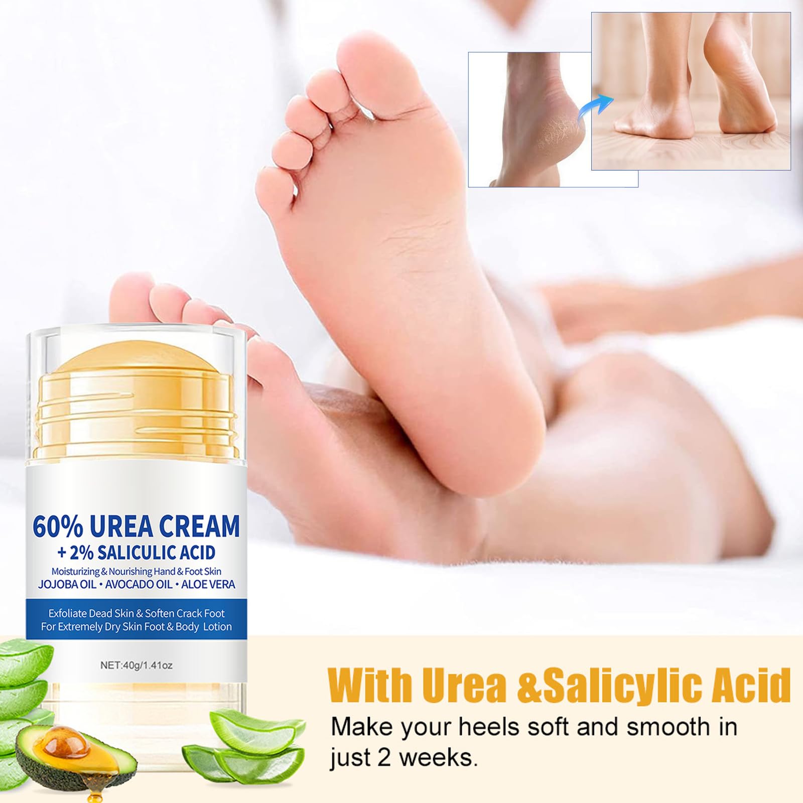 2 Pezzi Crema Piedi Secchi Screpolati, 60% Crema Urea Piedi, crema Talloni Screpolati, Mani e screpolati Rimozione e Ammorbidimento Dei Calli