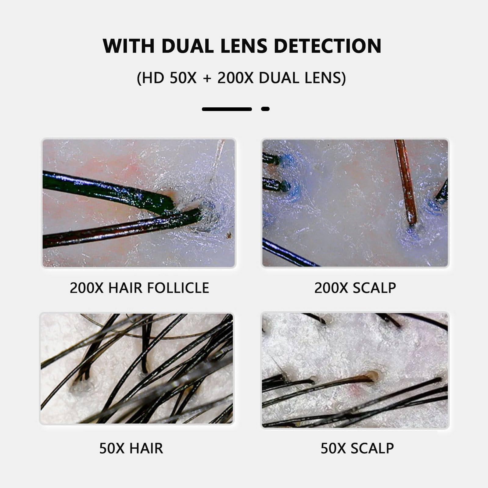 Hauthaaranalysator, 27,9 cm HD LCD Sn 50X/200X Lupe, professionelles Analysegerät, All-in-One-Gerät, Follikelanalysator, Detektor für den Heimsalon, d (d)