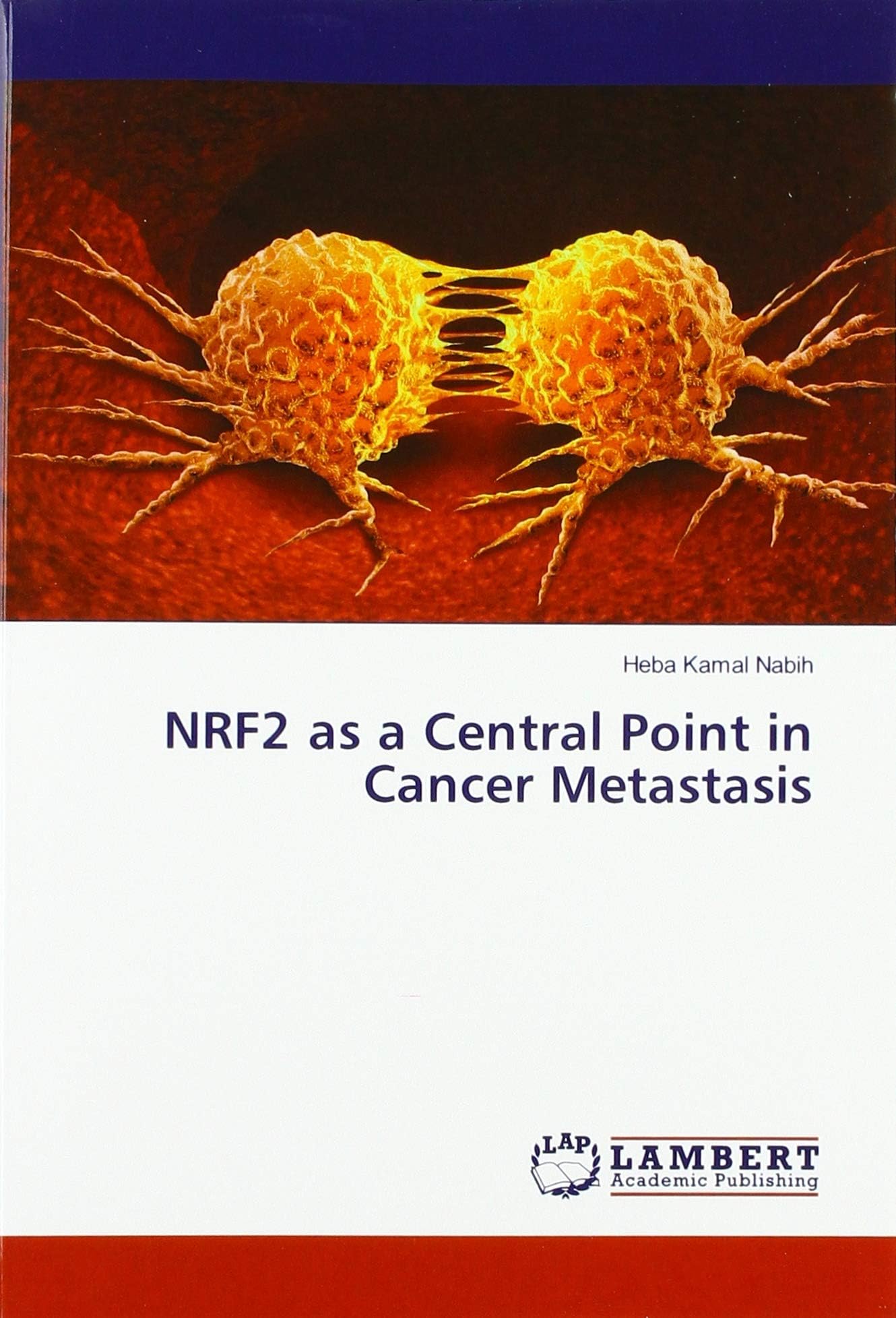 NRF2 as a Central Point in Cancer Metastasis
