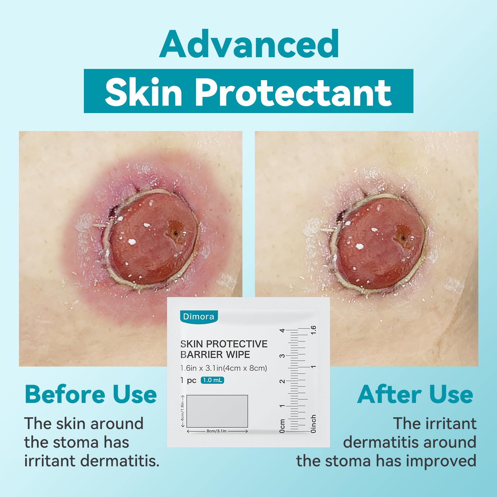 Dimora Skin Barrier Wipes - Alcohol-Free & Gentle -4