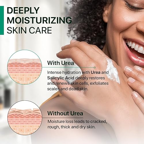 Miniatura 9 de REMEDIAL PAX Urea Cream 40 Percent for Feet, 40% Urea Foot Cream for Dry Cracked Heels Knees Elbows Callus Hands Repair Treatment with 2% Salicylic
