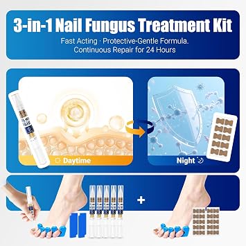 Toenail Fungus Treatment Extra Strength Pen for Damaged Toenail | More Pure Natural Plant Extracts, Toe Nail Fungus Renewal Patches & Toe Spacers for Damaged Nail for Women and Men