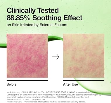 ANUA Azelaic Acid 10 Hyaluronic Acid Soothing Toner Pads, Hydrating Facial Mask for Redness, Pore & Blemish Care, Quick & Easy Stretchable Formula, Korean Skincare, 90 Pads