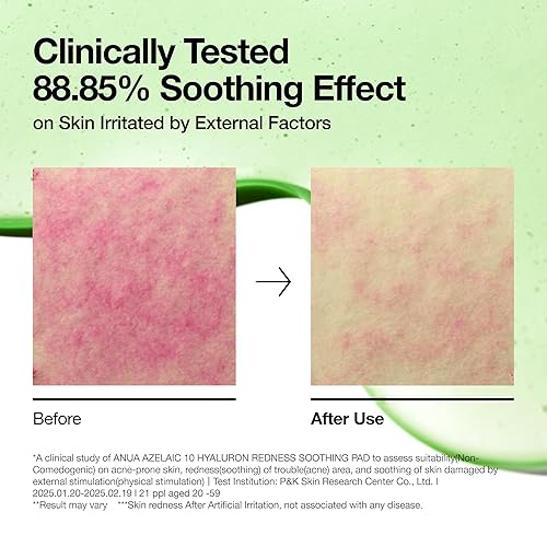 Miniatura 6 de Anua Azelaic 10 Hyaluron - Almohadilla calmante para el enrojecimiento con almohadillas de tóner coreano, máscara facial elástica rápida y fácil con
