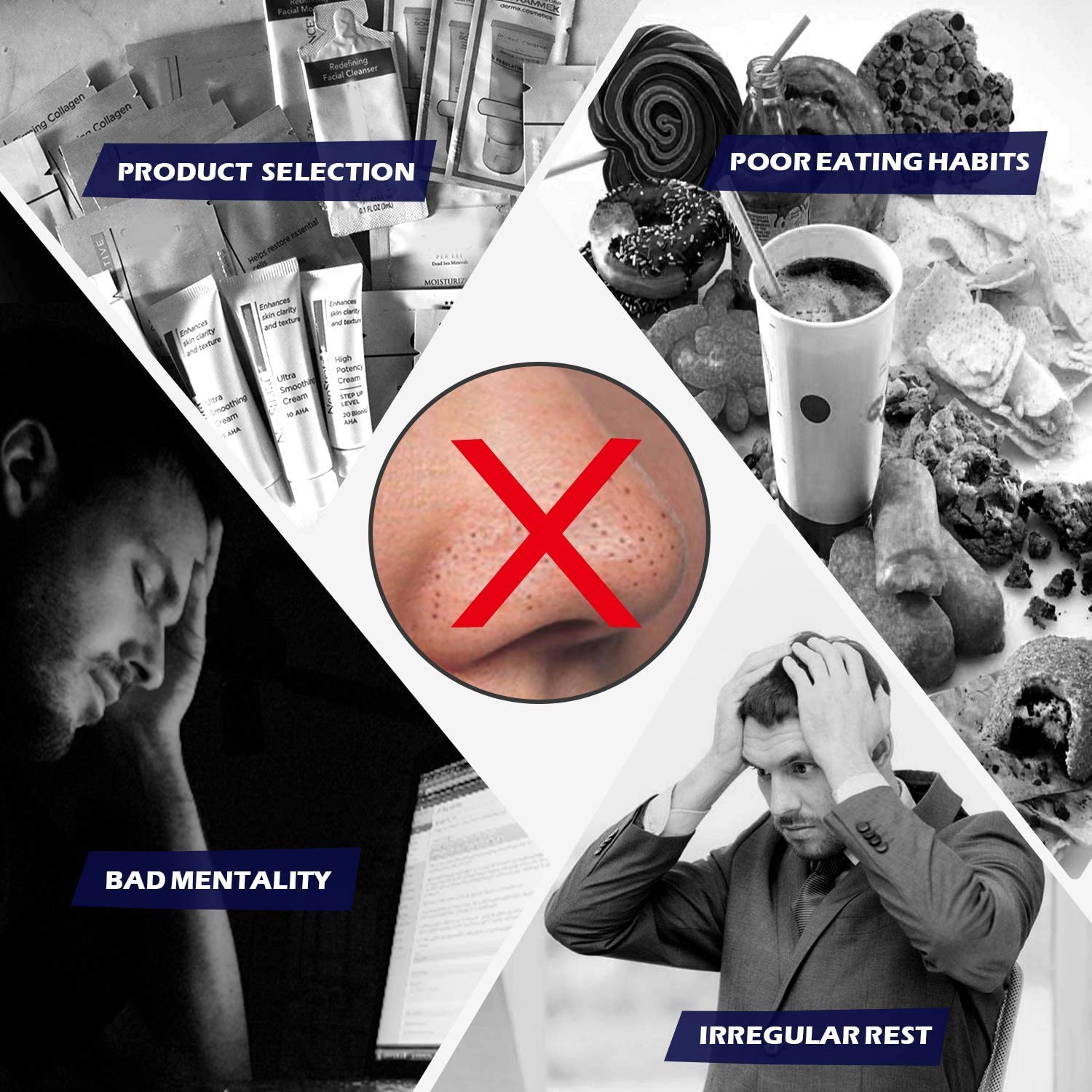 JOLVKA Blackhead Pore Strips Remover For Men,(29 Strips), Deep Cleansing Strip With Charcoal and Oil Free Peel Off Strip : Beauty & Personal Care