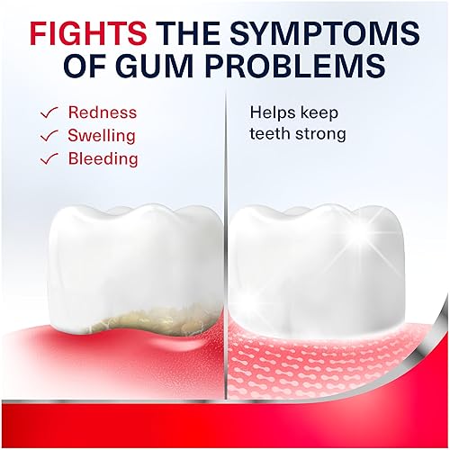 Miniatura 5 de Parodontax Pasta dental de protección completa para sangrado de encías paquete de de 1 Parodontax Completo
