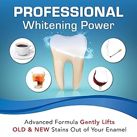 Plus White Whitening Kit - 5 Minute Speed Whitening Gel & Comfort Fit Mouth Tray - Professional Teeth Whitening Kit w/Dentist Approved Ingredient for Tooth Whitening (2 oz)