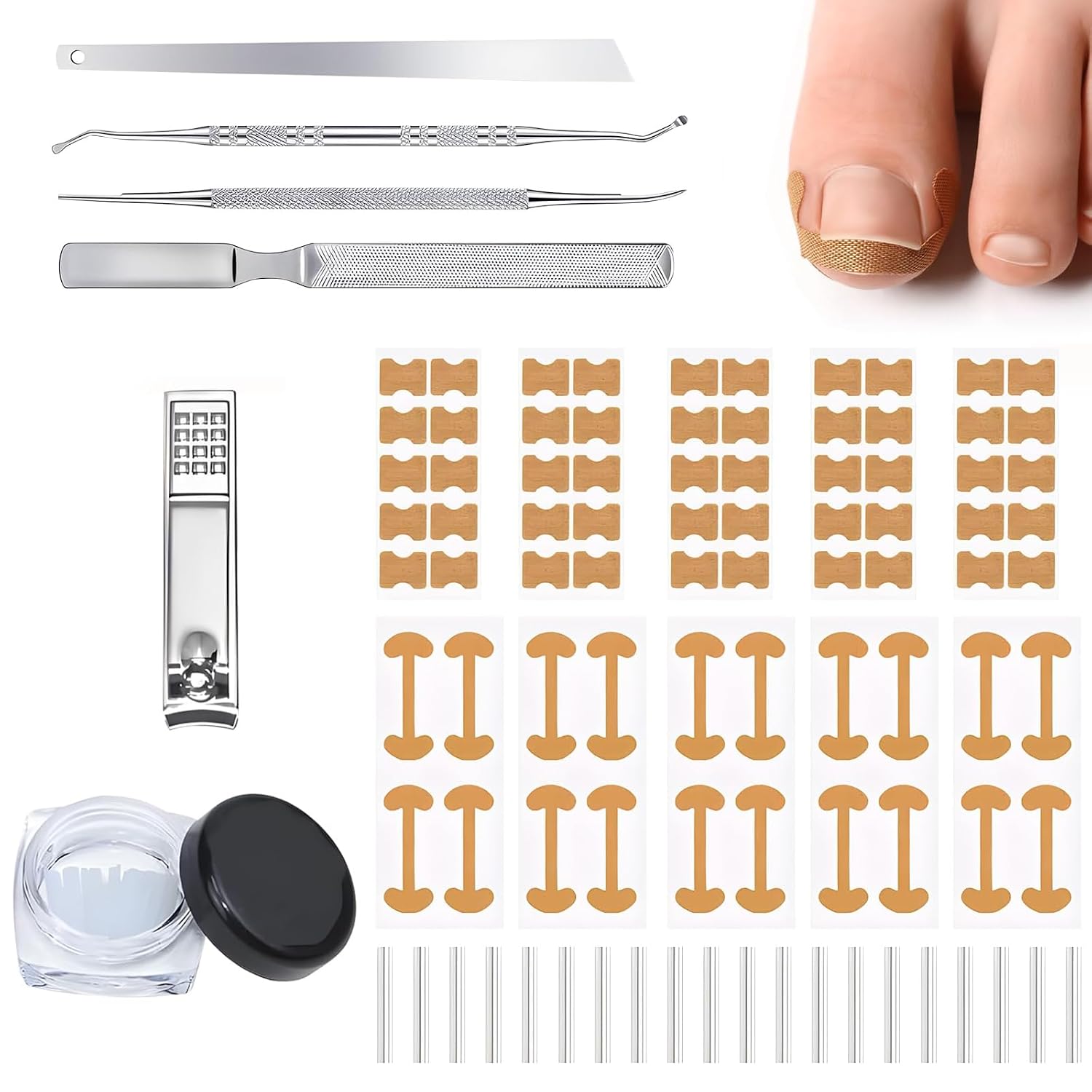 Home Ingrown Toenail Treatment Kit - 64 Reusable Strips in 3 Styles with 2 Painless Pedicure Tools for Safe Nail Correction, 1 pack