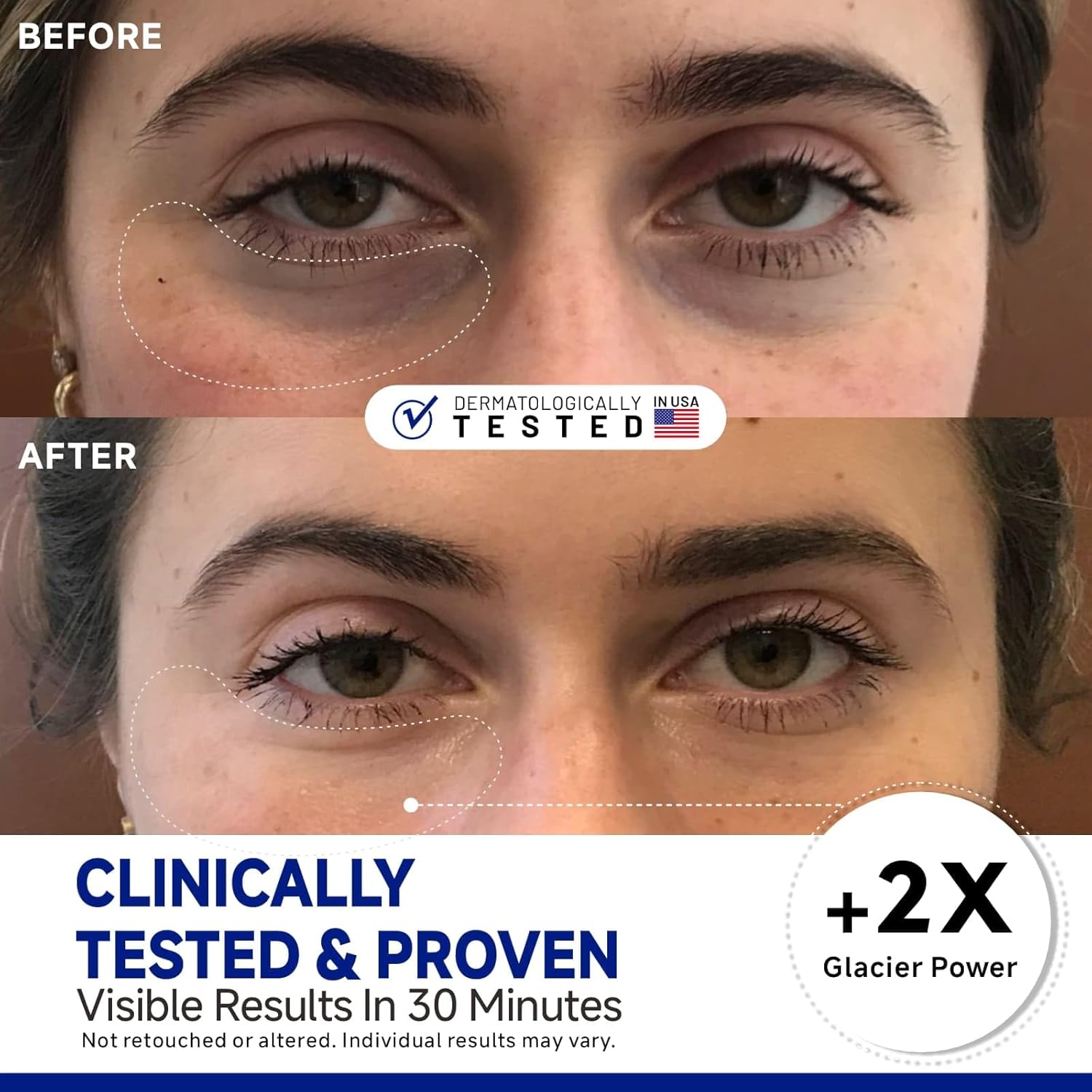 Peptide Cooling Under Eye Patches, Soothing Eye Patches Instant Reduces Dark Circles and Puffiness, Calming Under Eye Mask with Glacial Water for Bags Treatment, 12 Pairs - Image 2